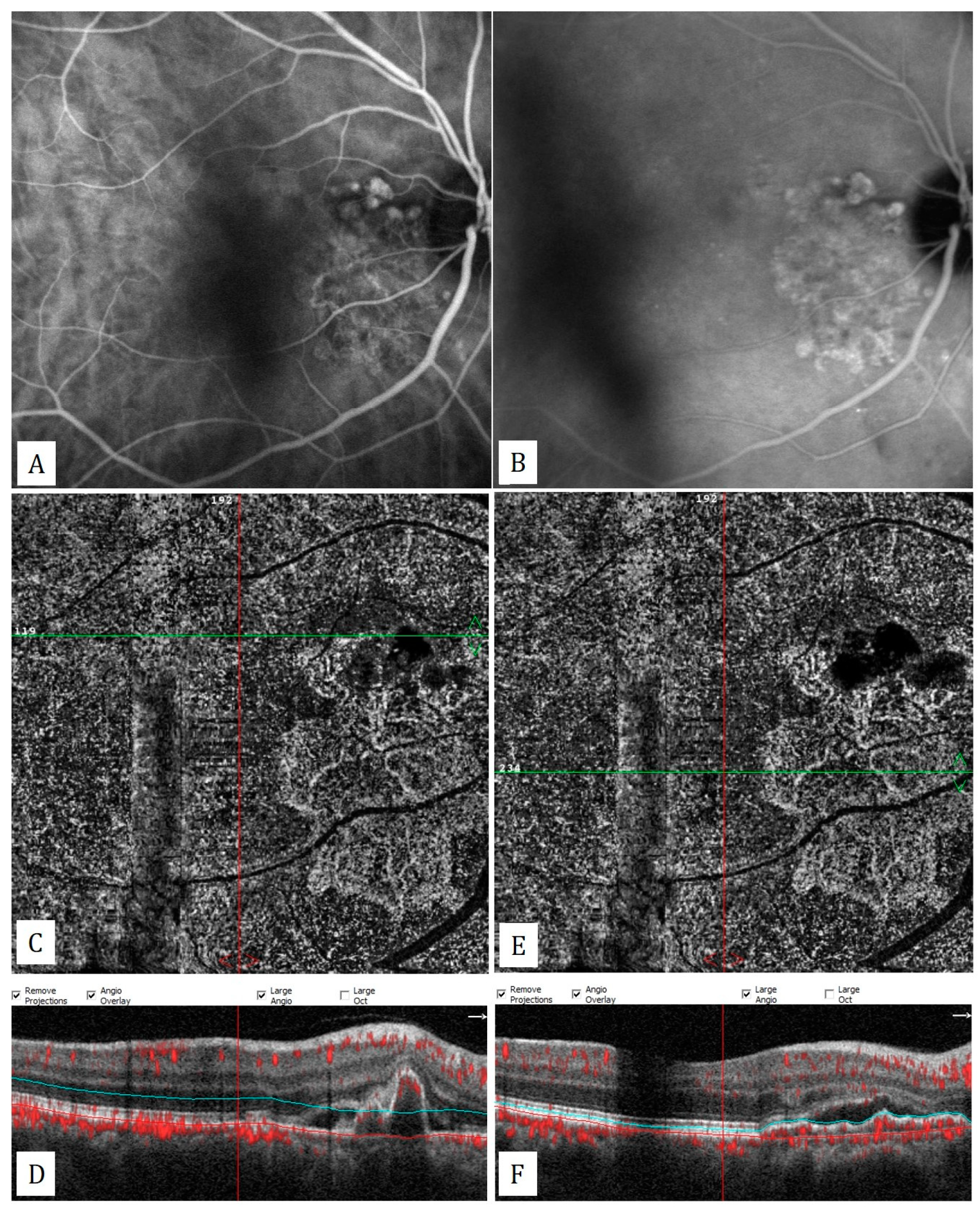 Diagnostics 13 01820 g006