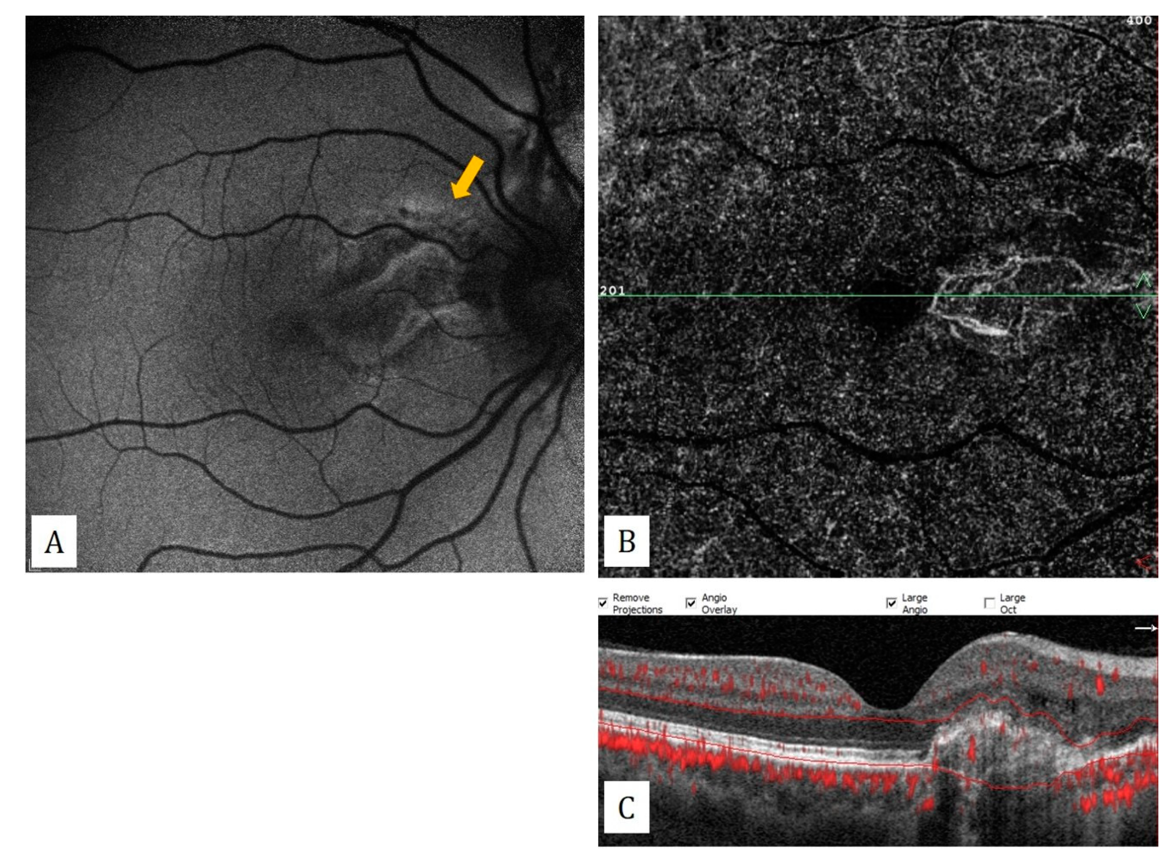 Diagnostics 13 01820 g007