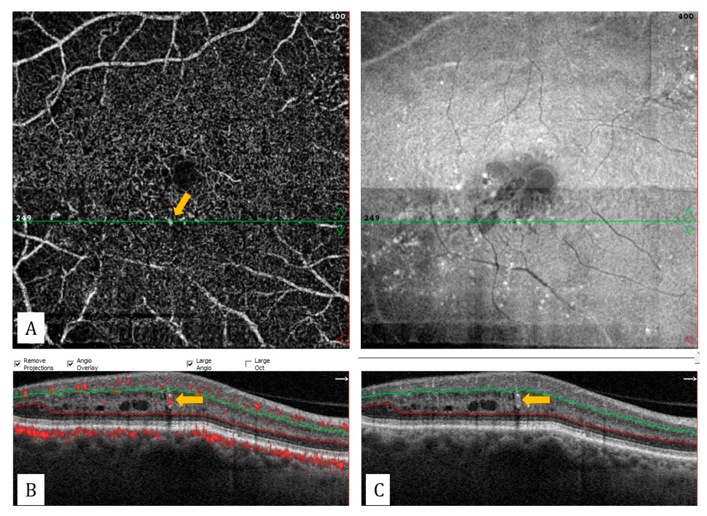 Diagnostics 13 01820 g011