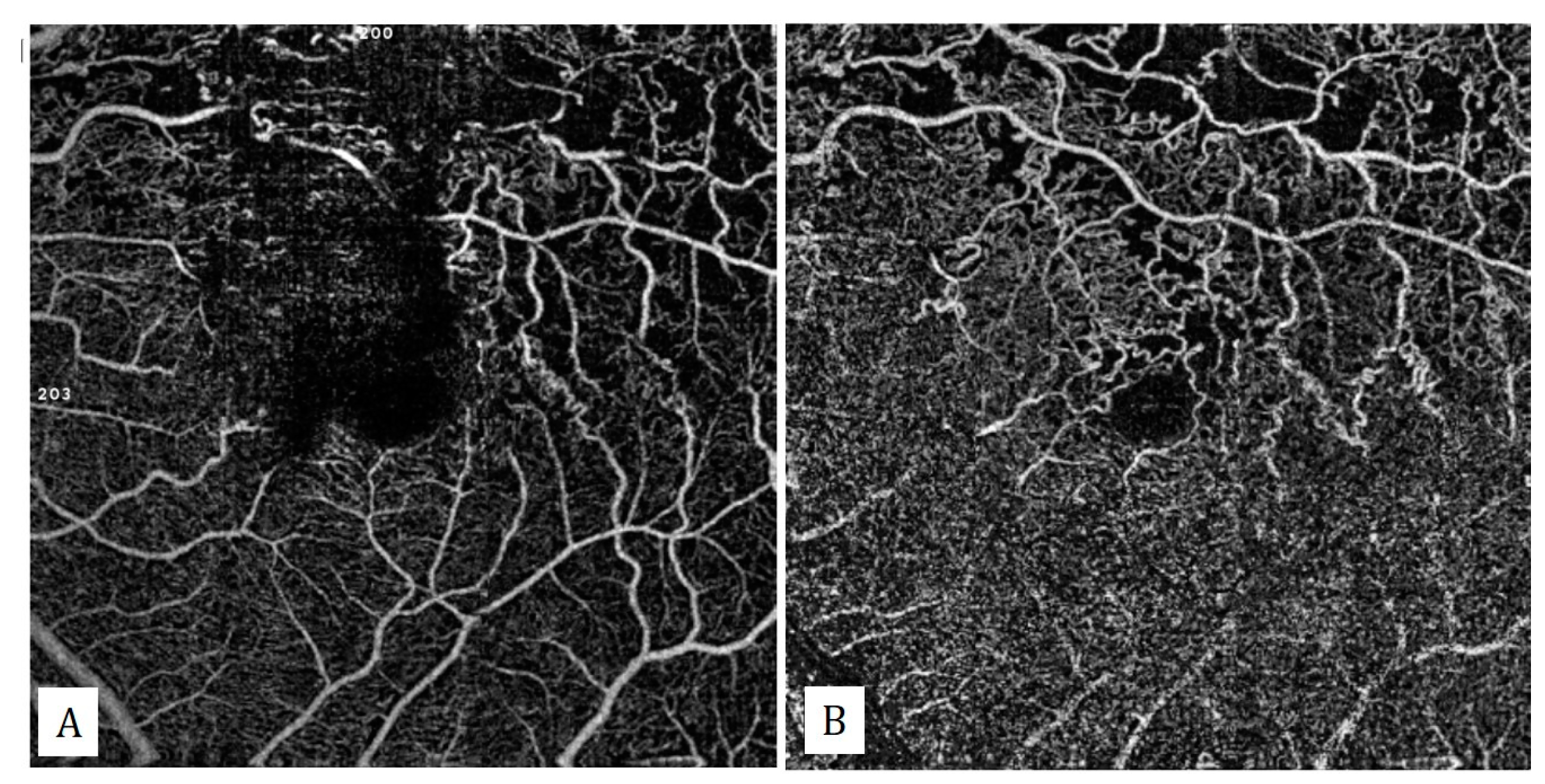 Diagnostics 13 01820 g012
