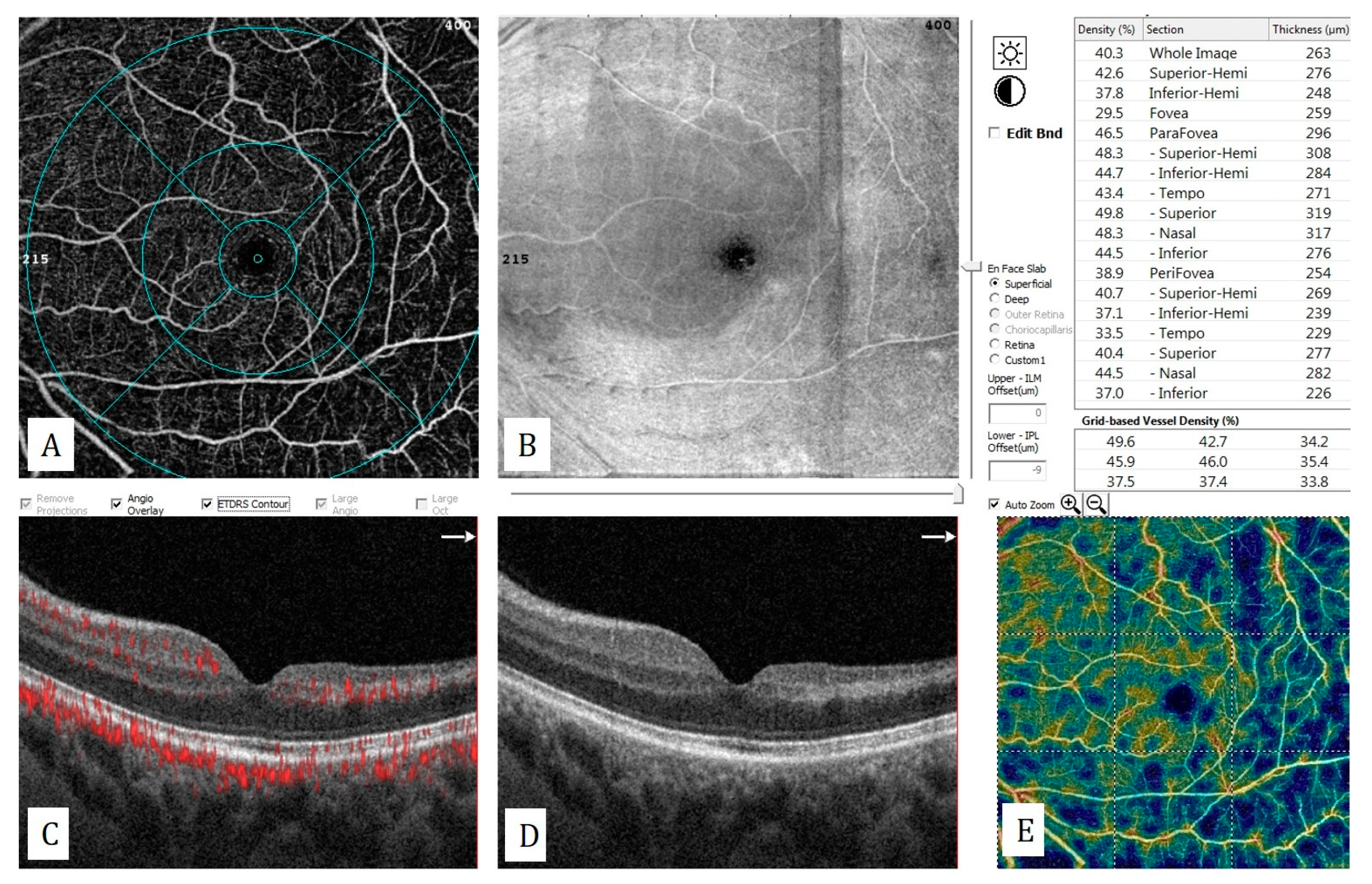 Diagnostics 13 01820 g013