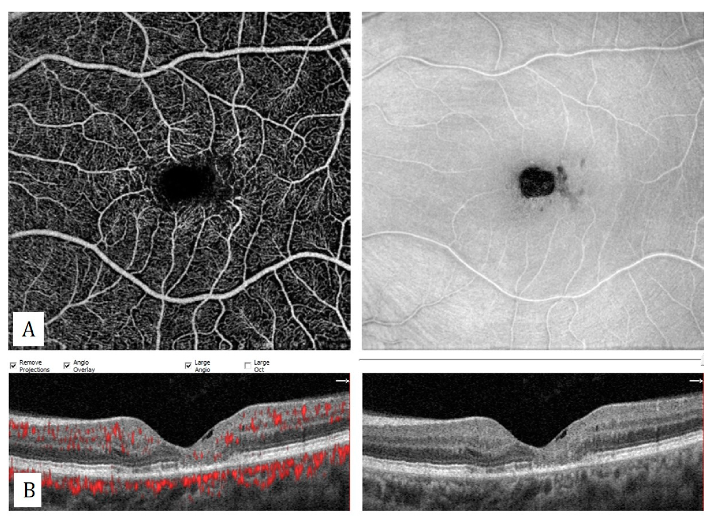 Diagnostics 13 01820 g014
