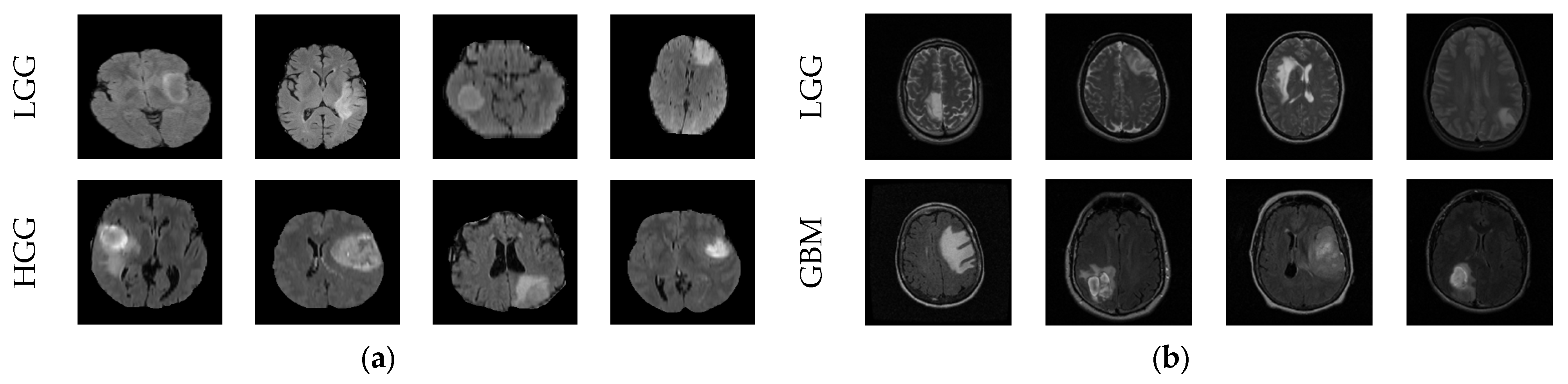 Diagnostics 13 01832 g002