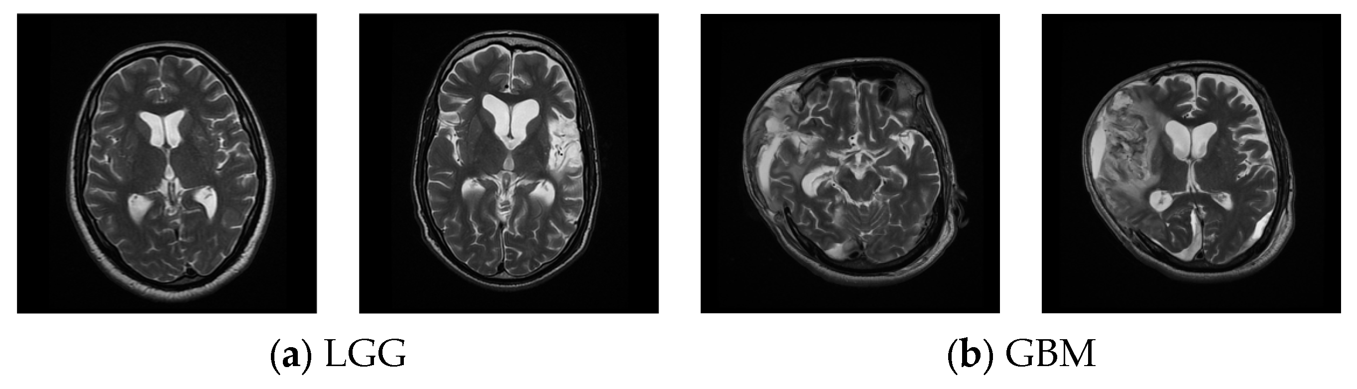 Diagnostics 13 01832 g003