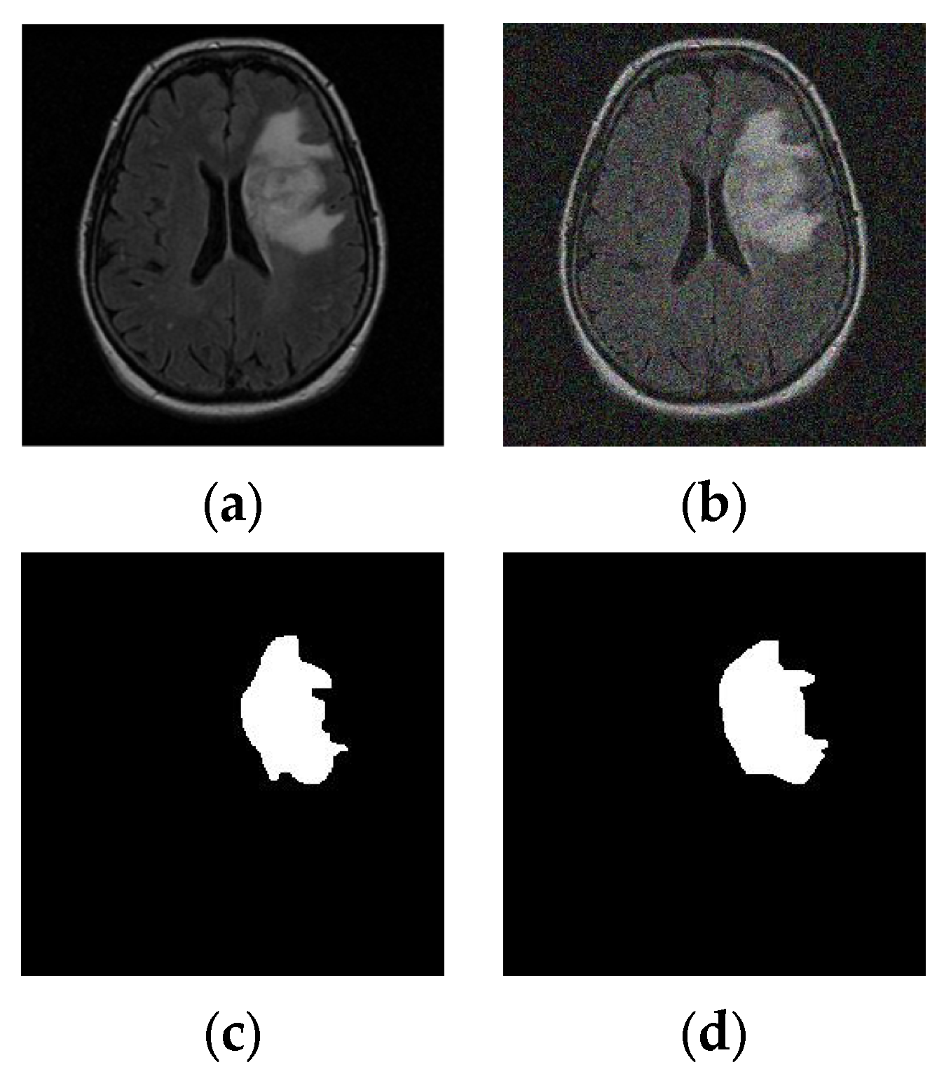 Diagnostics 13 01832 g004