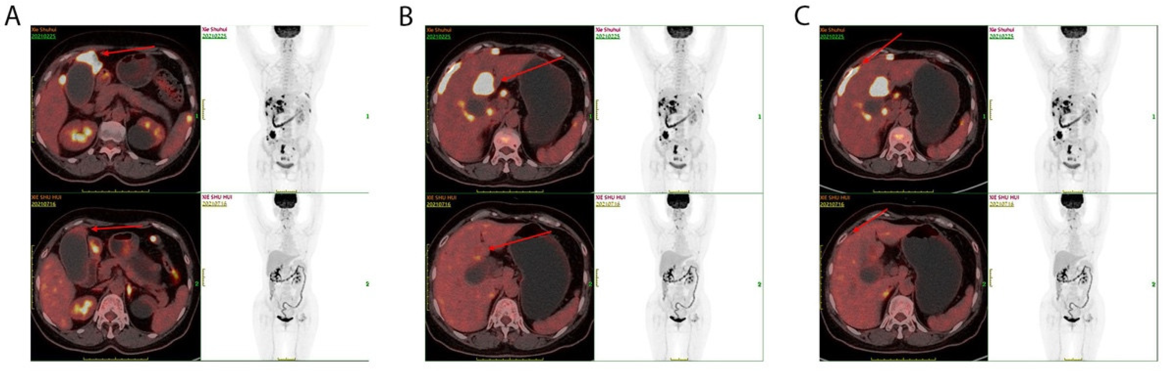 Diagnostics 13 01833 g002