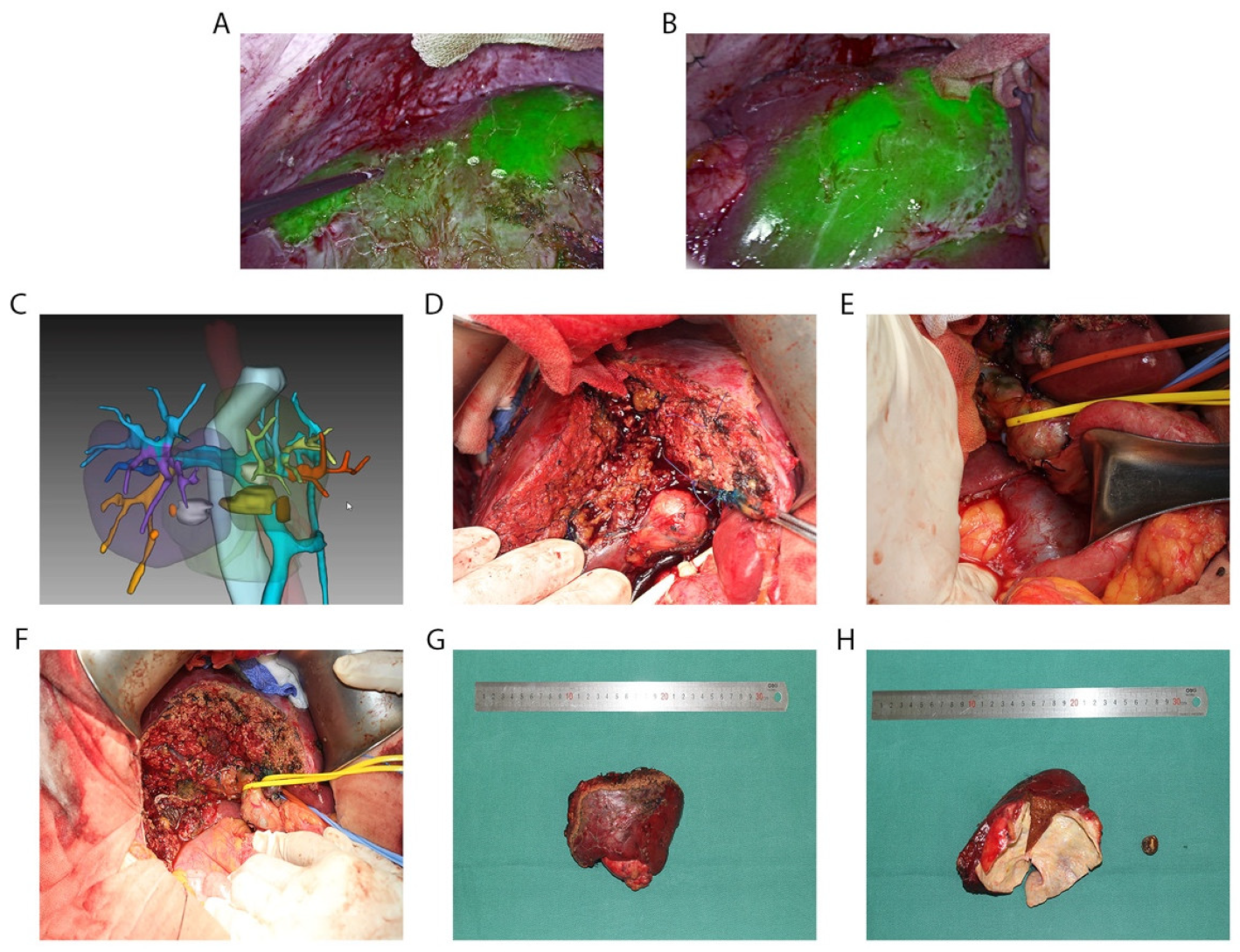 Diagnostics 13 01833 g003