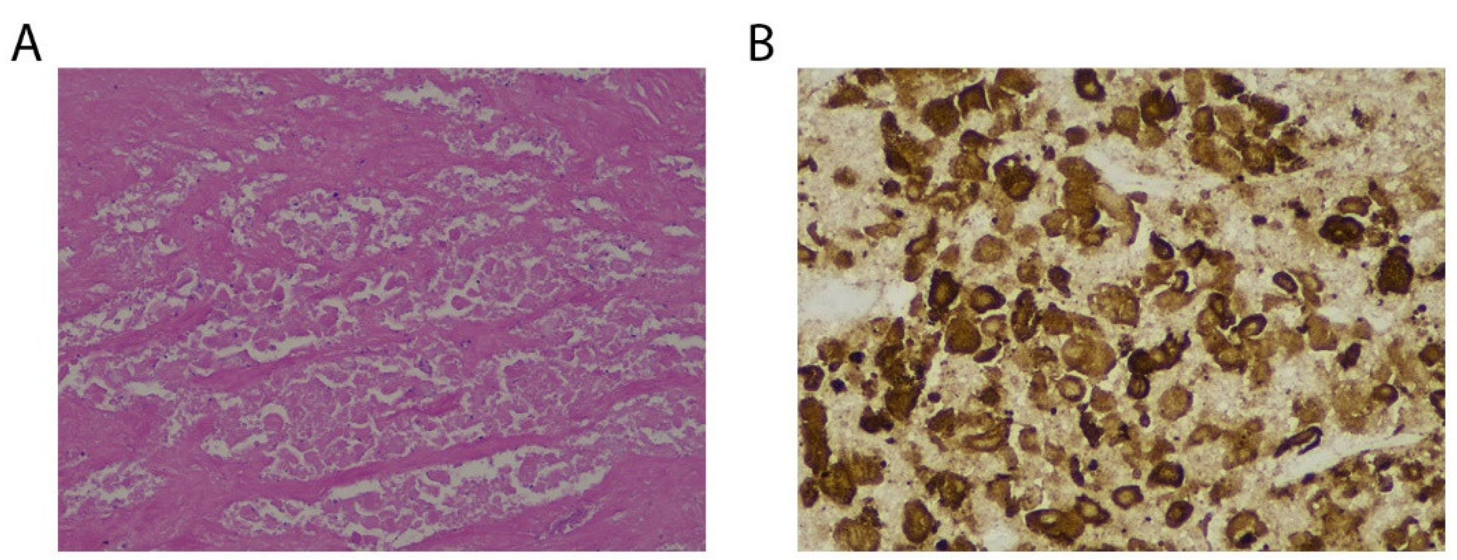 Diagnostics 13 01833 g004