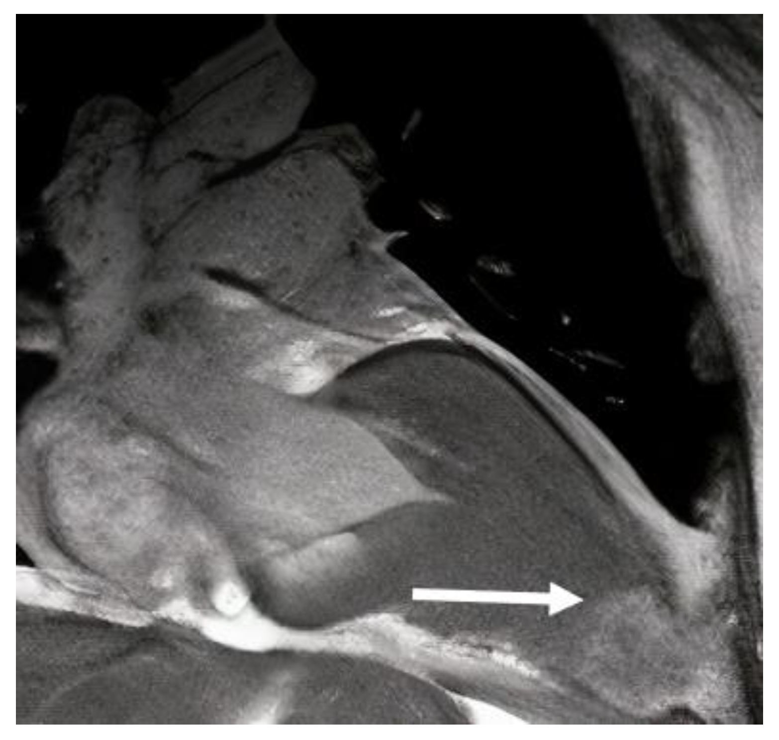 Diagnostics 13 01848 g005