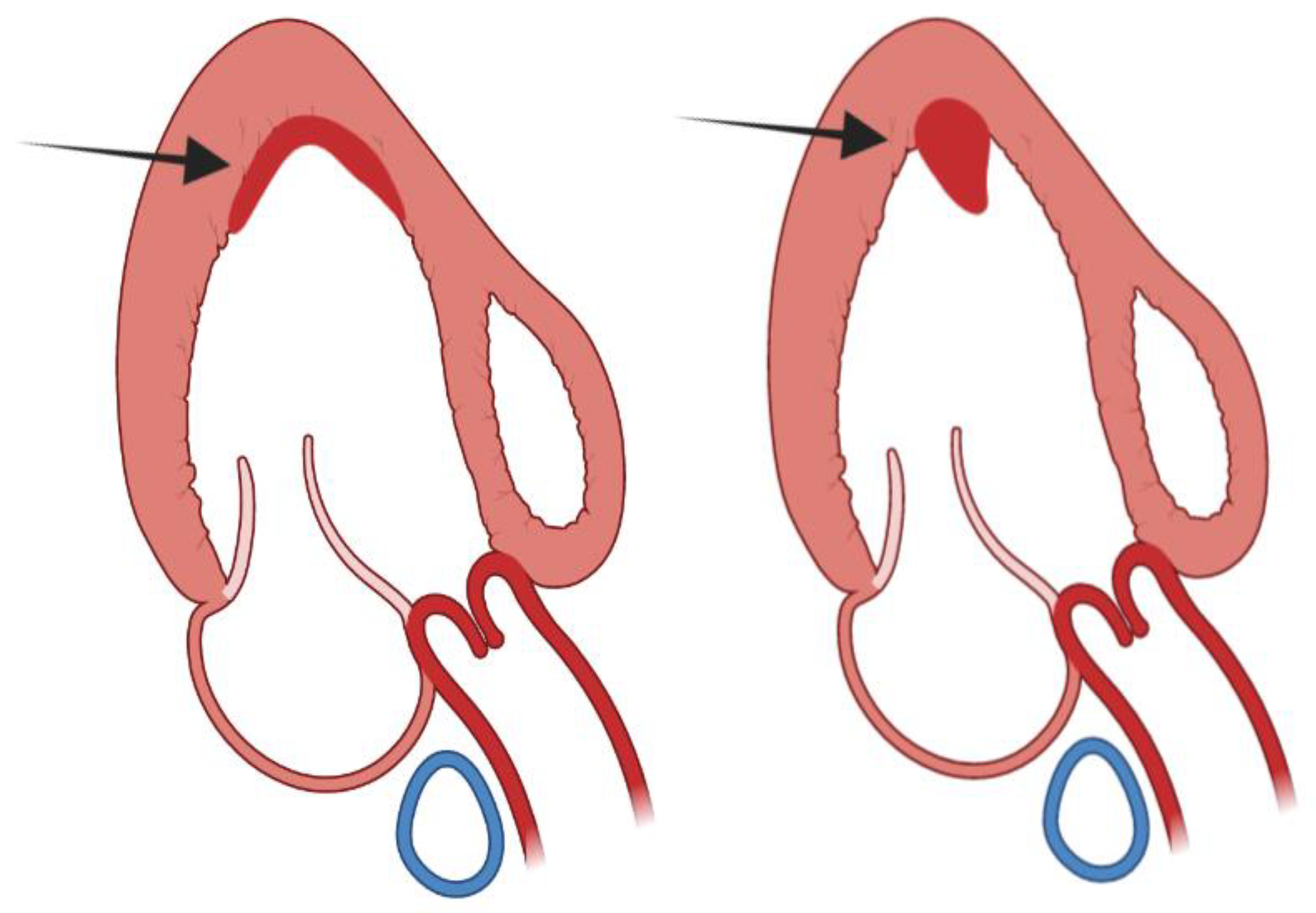 Diagnostics 13 01848 g009