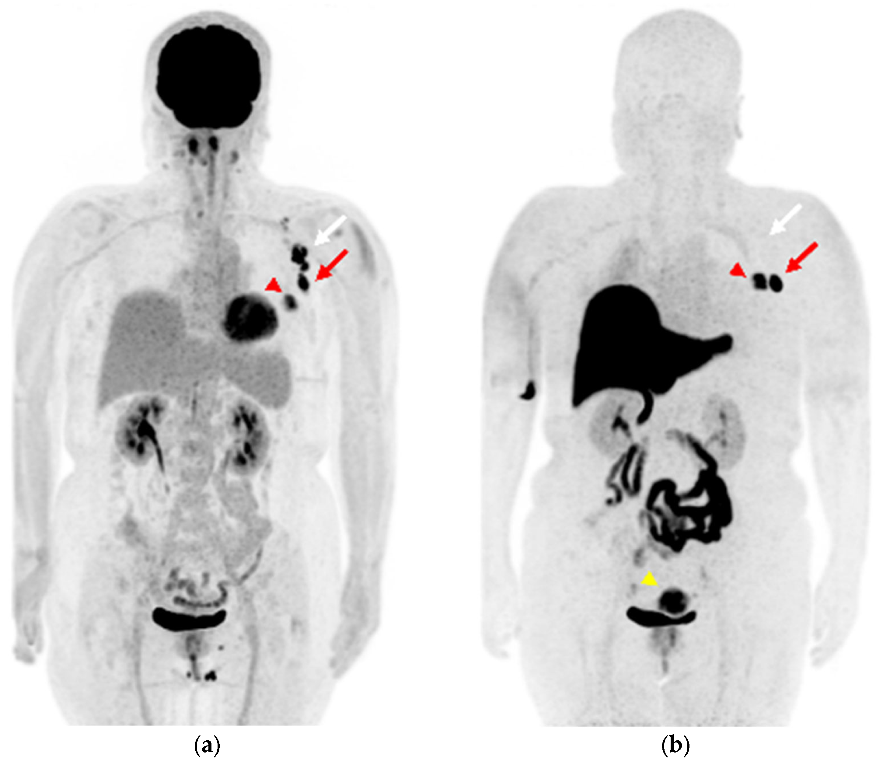 Diagnostics 13 01851 g001 Diagnostics 13 01851 g001