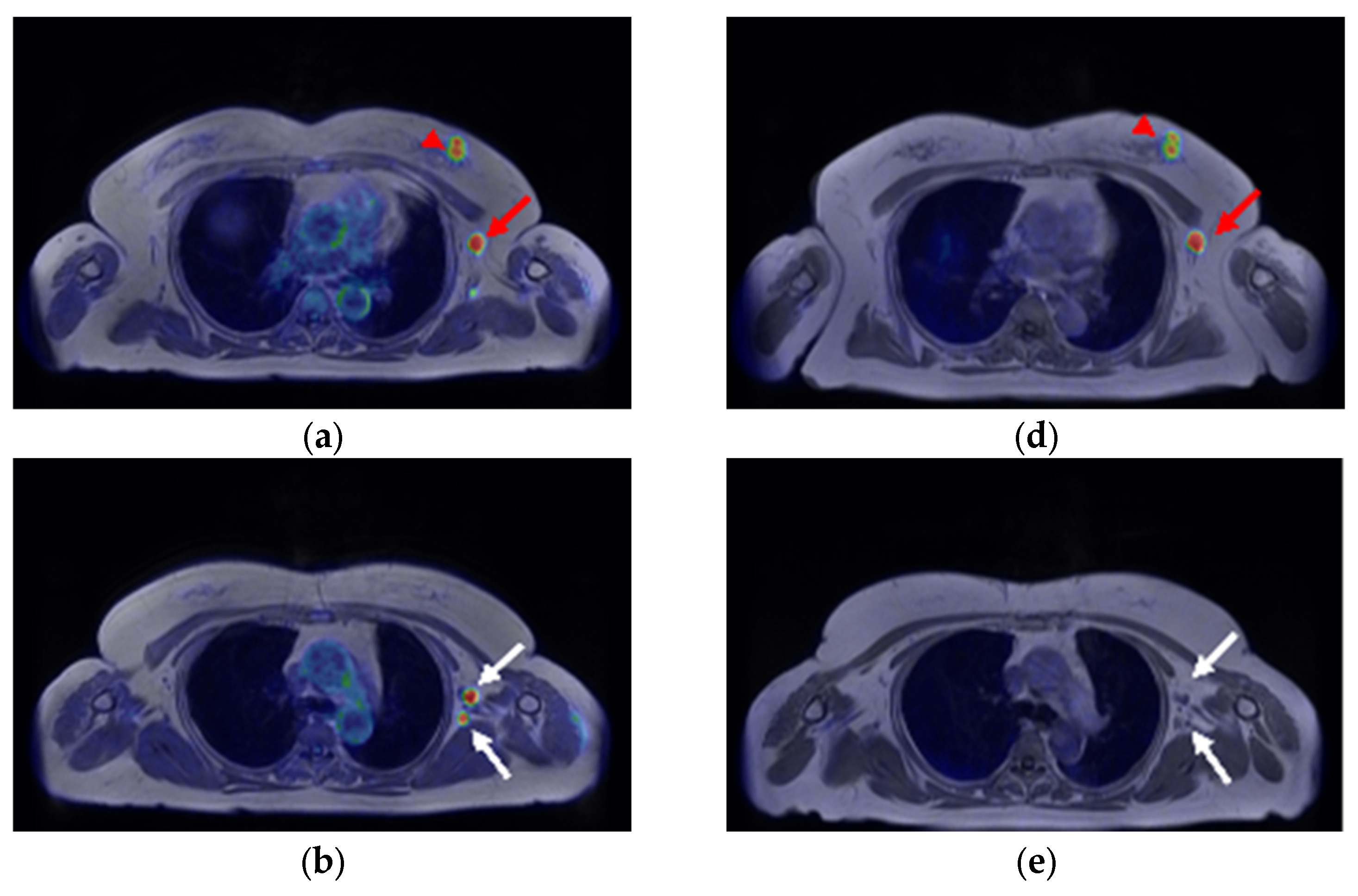 Diagnostics 13 01851 g002a Diagnostics 13 01851 g002a