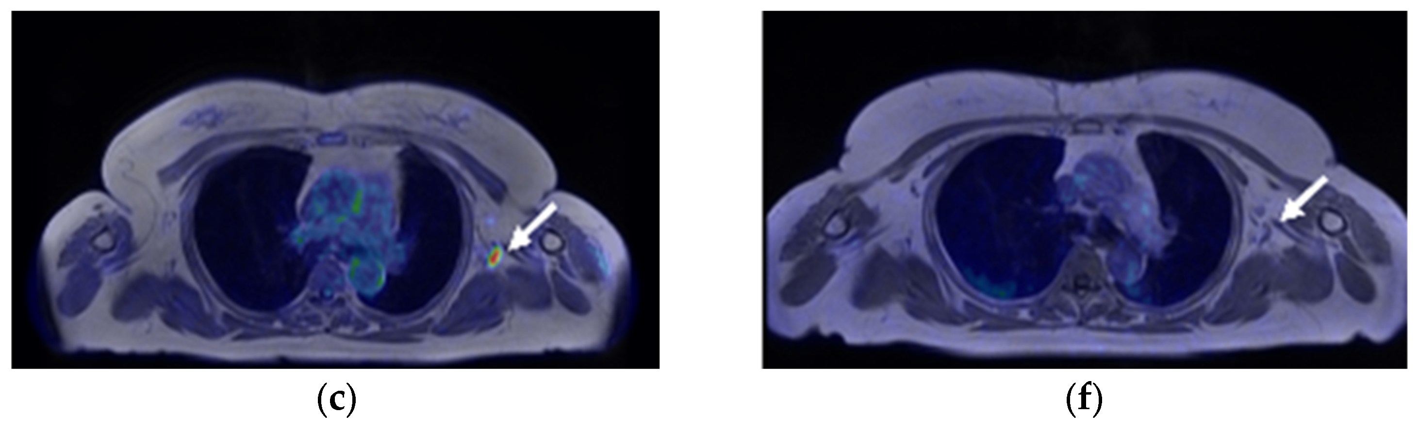 Diagnostics 13 01851 g002b Diagnostics 13 01851 g002b