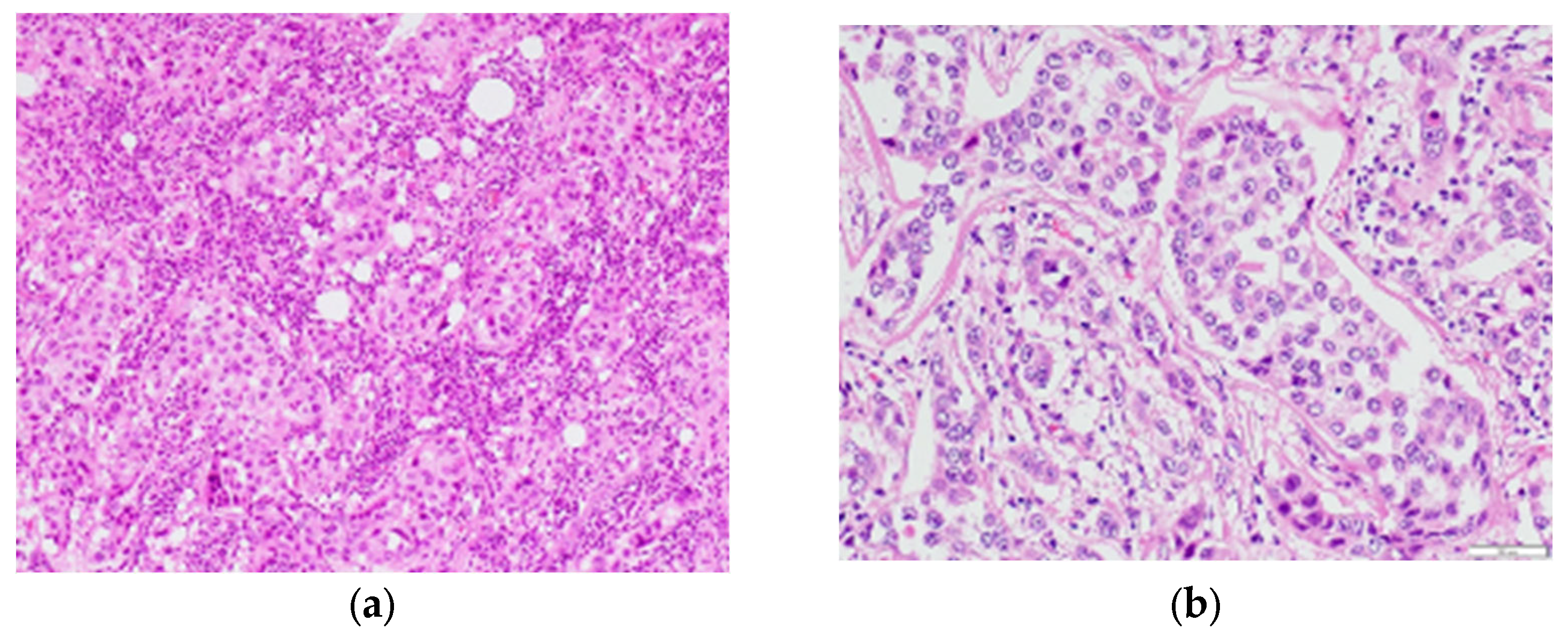 Diagnostics 13 01851 g003 Diagnostics 13 01851 g003