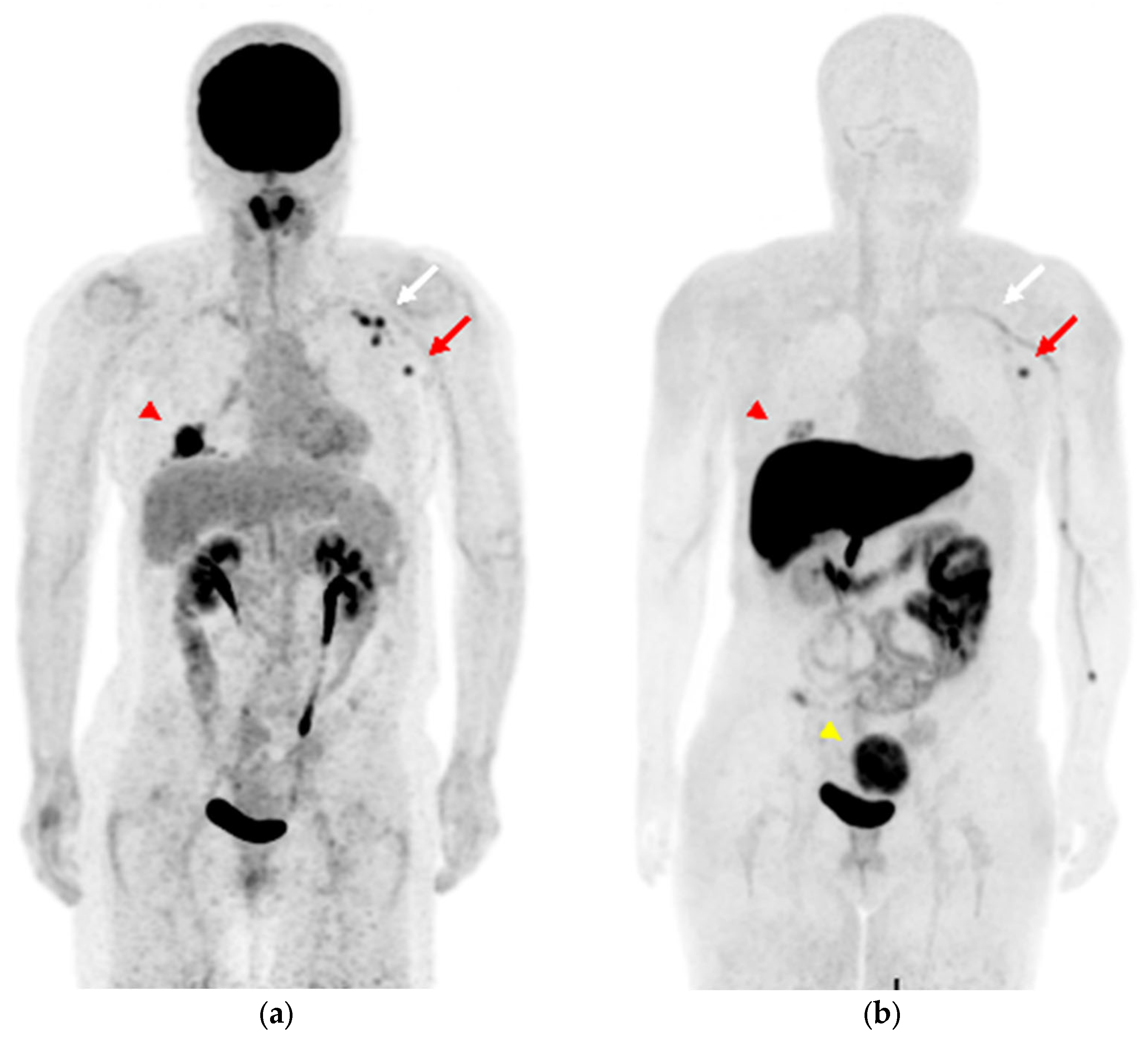 Diagnostics 13 01851 g004 Diagnostics 13 01851 g004