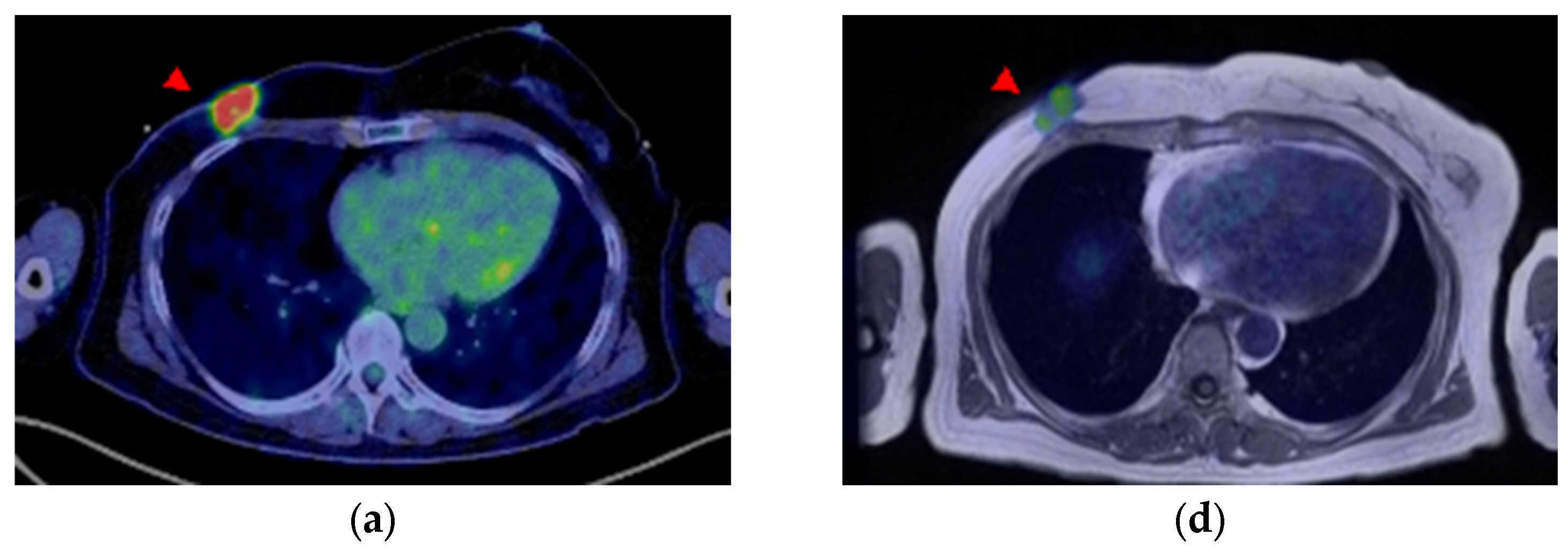 Diagnostics 13 01851 g005a Diagnostics 13 01851 g005a