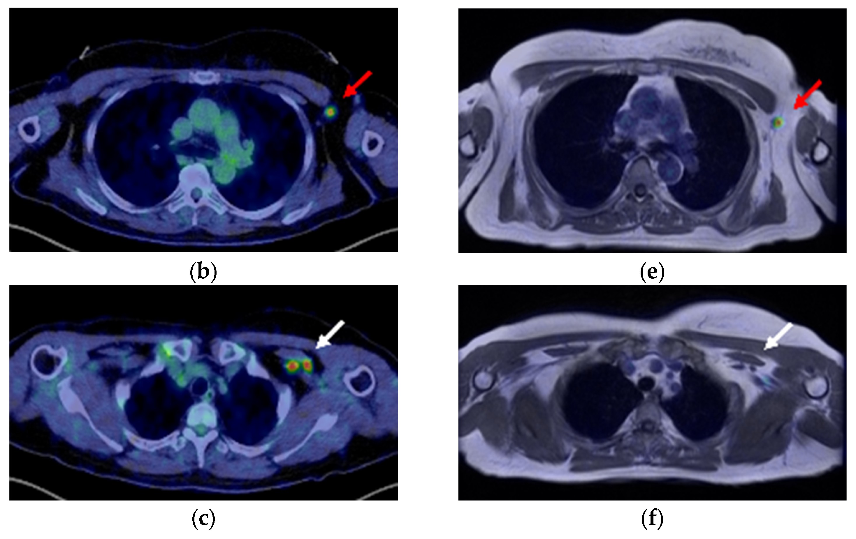 Diagnostics 13 01851 g005b Diagnostics 13 01851 g005b