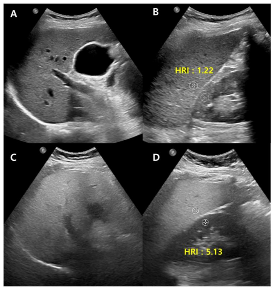 Diagnostics 13 01852 g002
