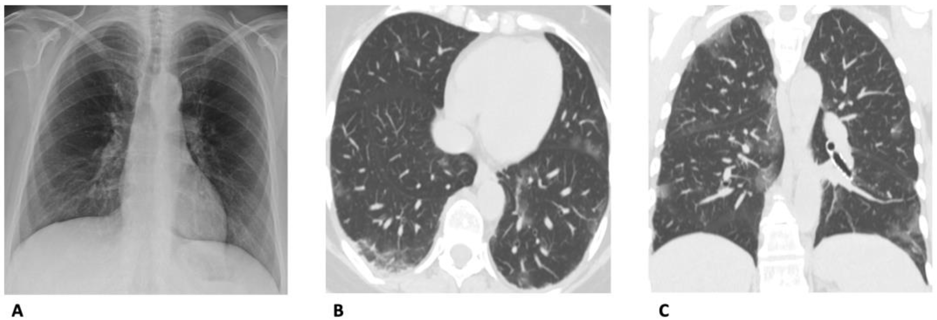 Diagnostics 13 01856 g002