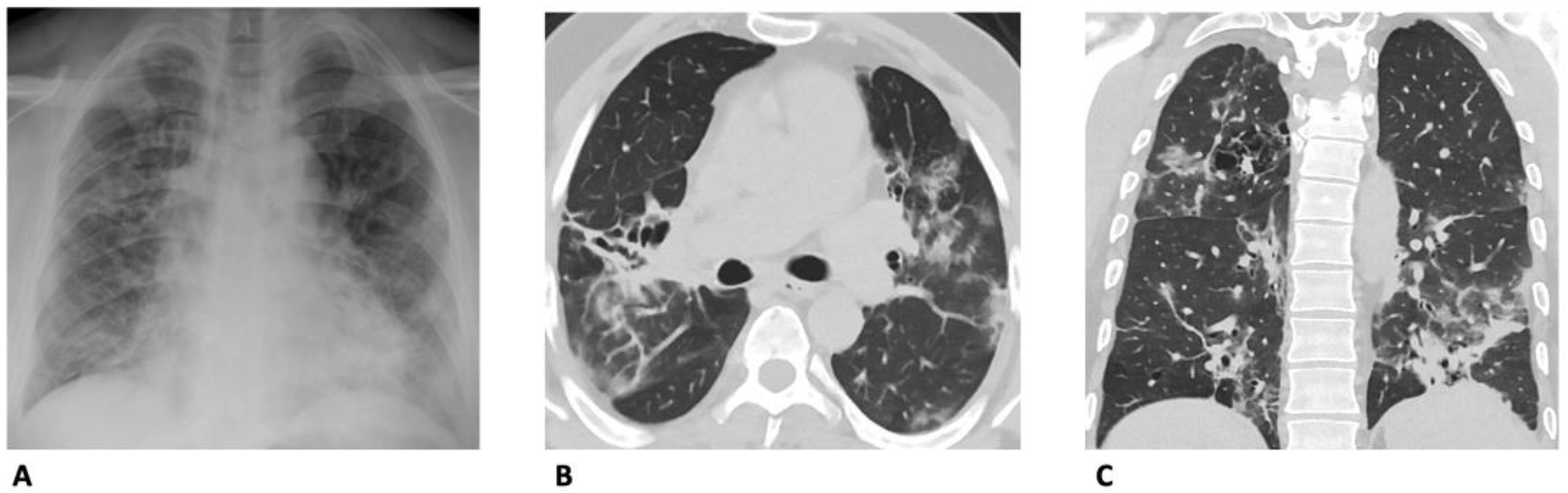 Diagnostics 13 01856 g003