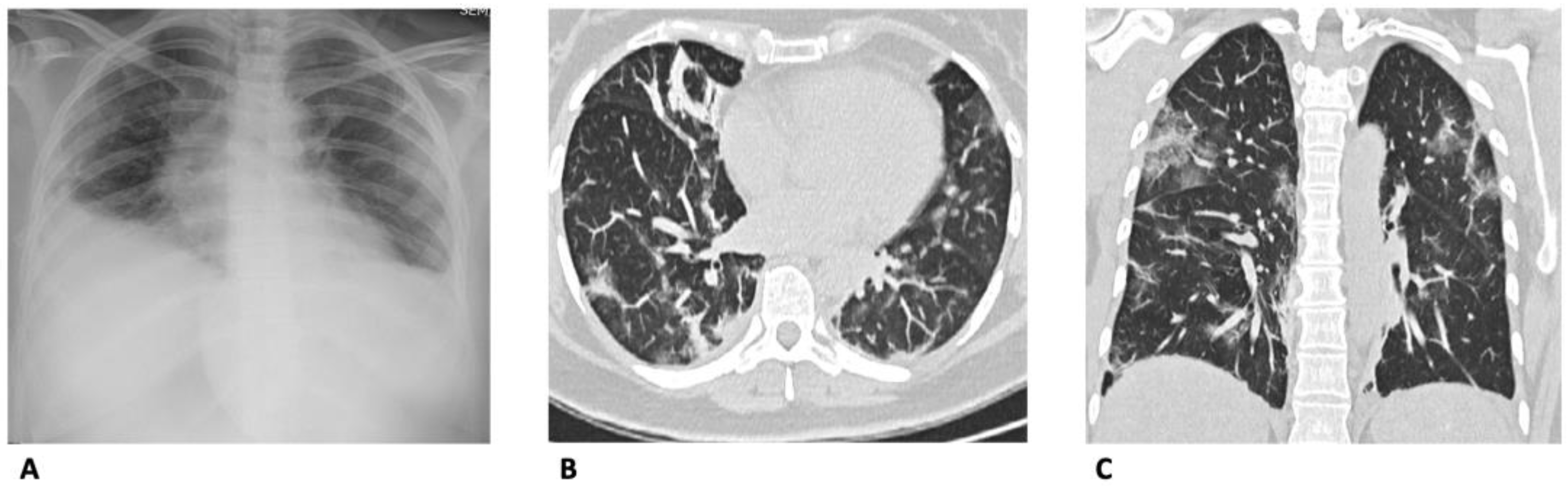 Diagnostics 13 01856 g004