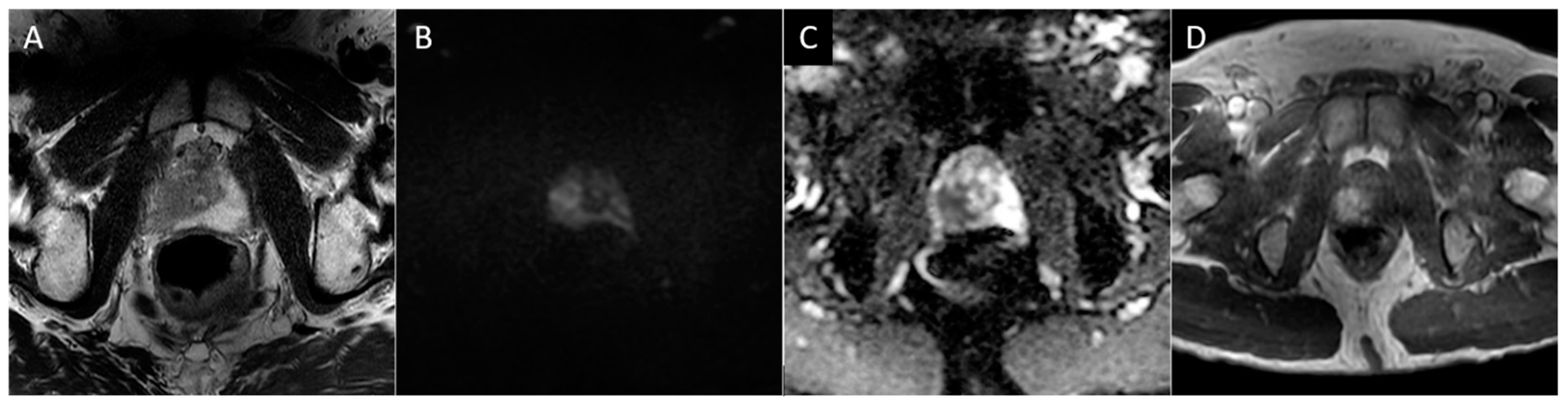 Diagnostics 13 01860 g002