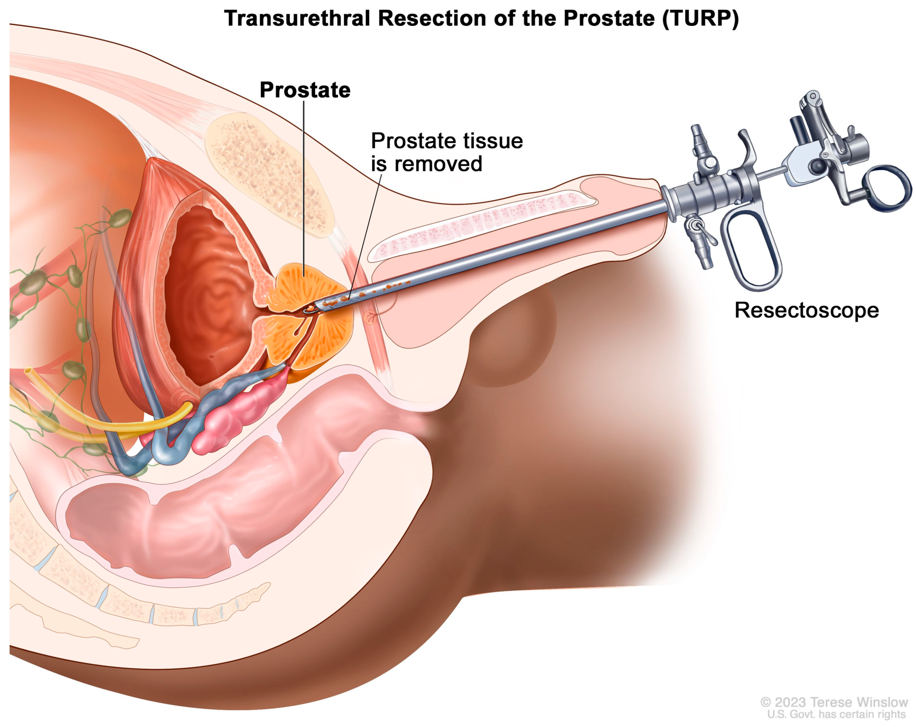 Diagnostics 13 01860 g004