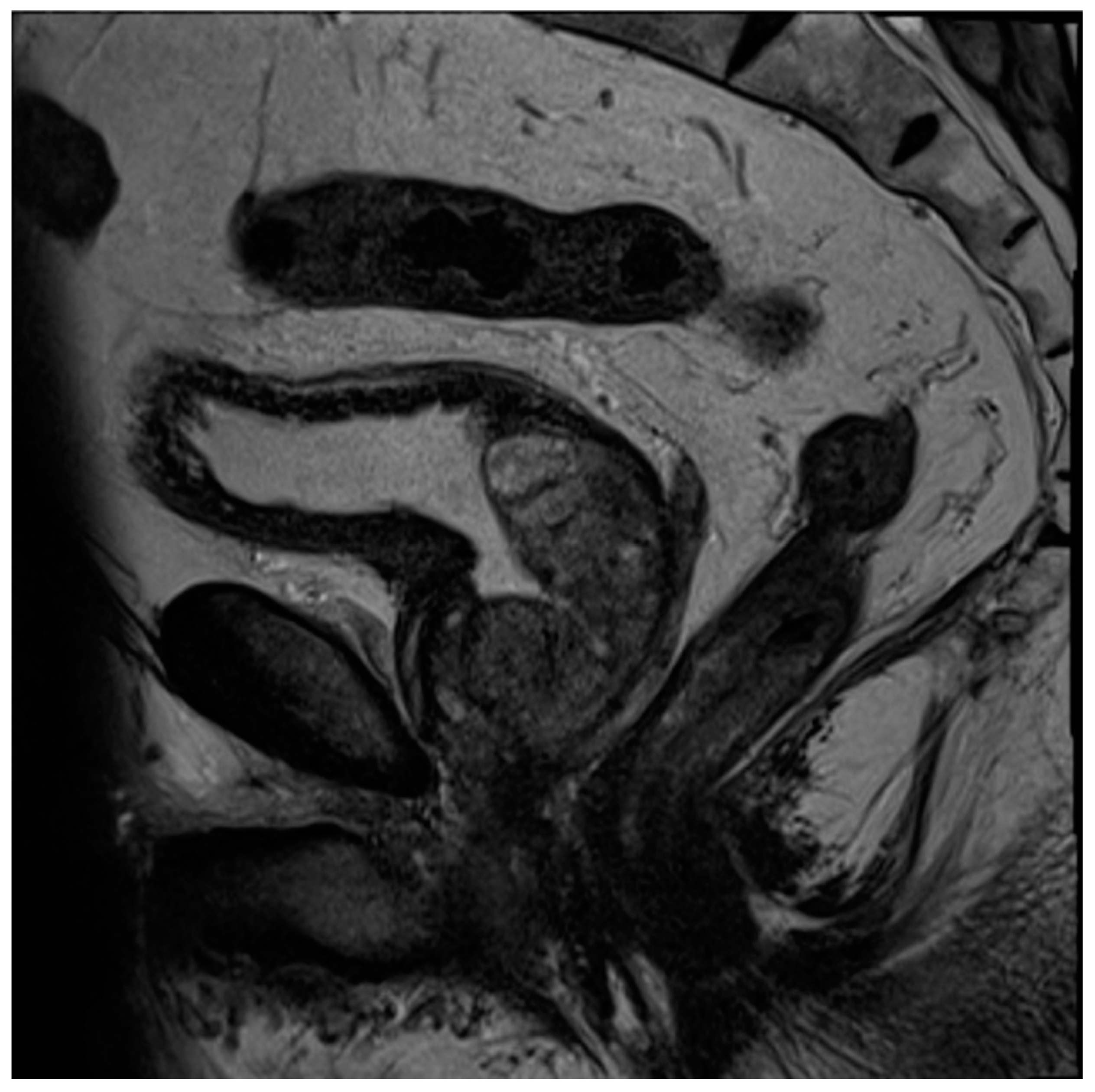 Diagnostics 13 01860 g005