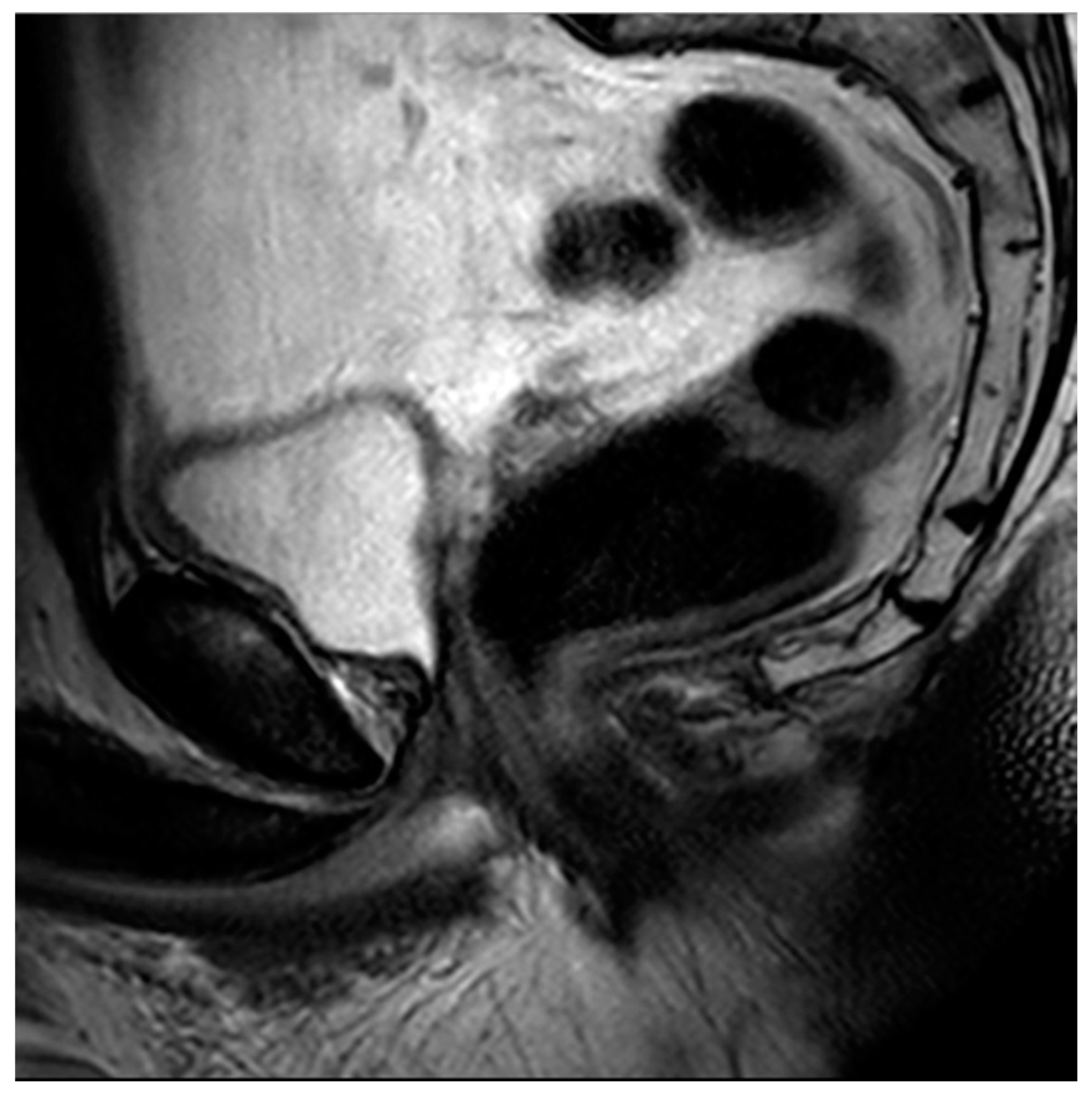 Diagnostics 13 01860 g008