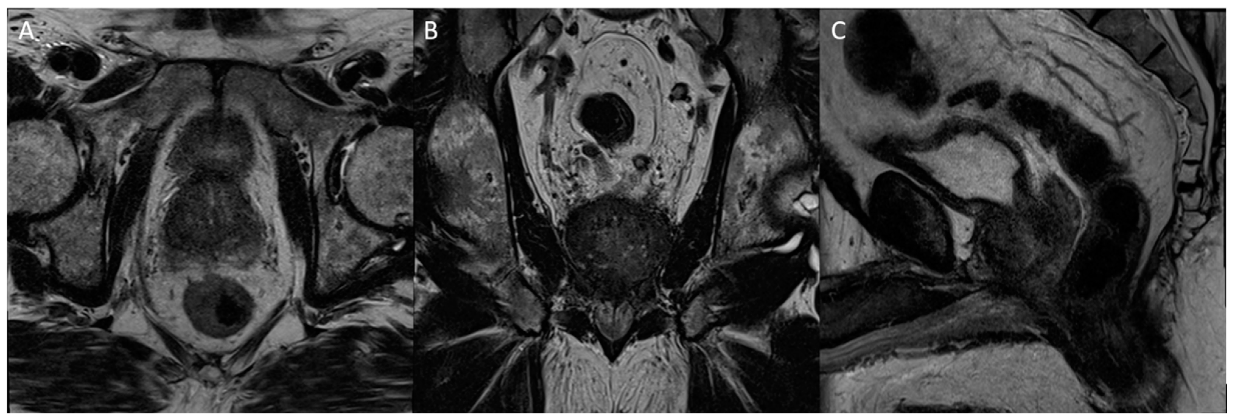 Diagnostics 13 01860 g009