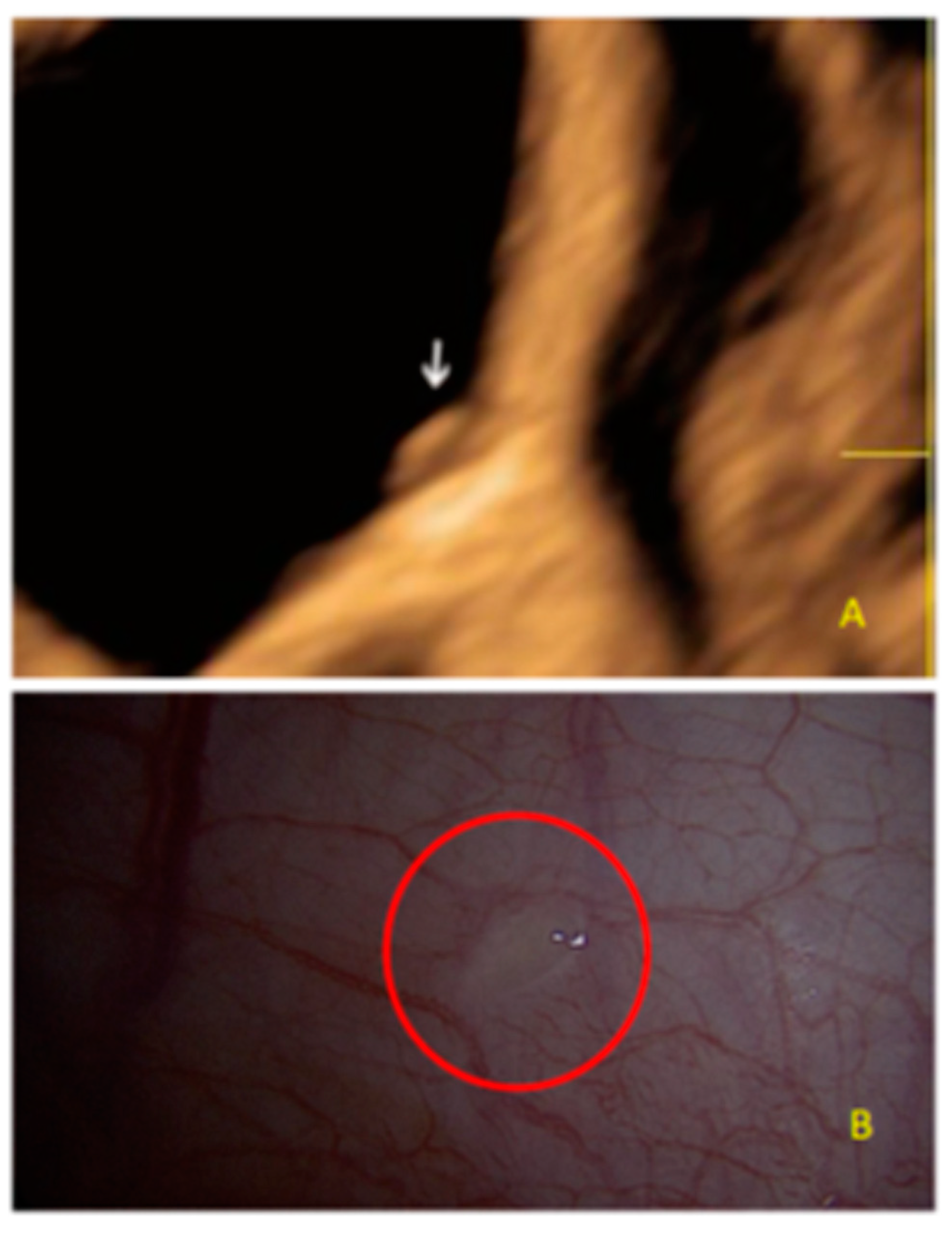 Diagnostics 13 01876 g002