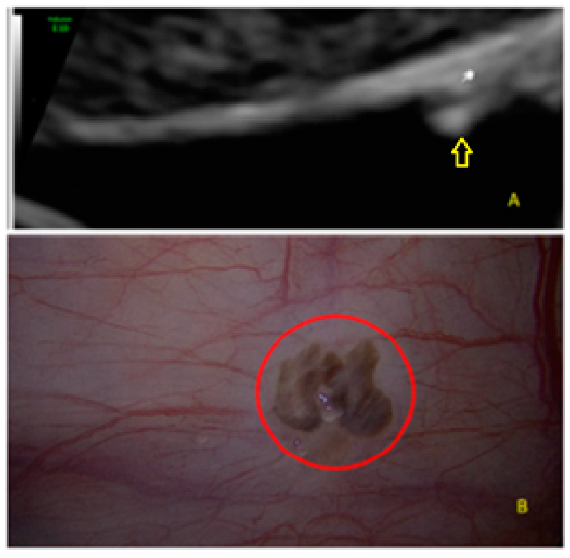 Diagnostics 13 01876 g003