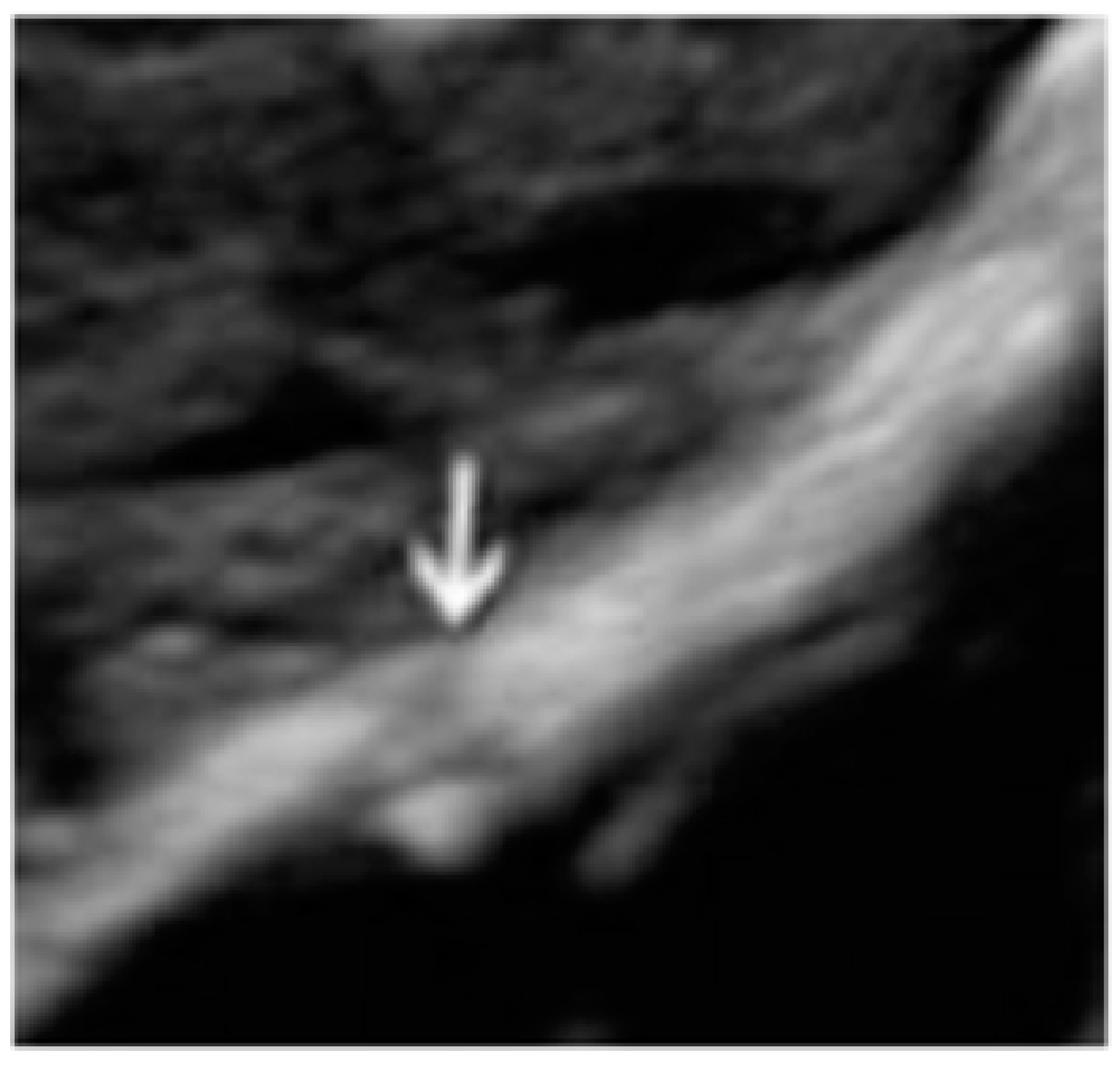 Diagnostics 13 01876 g004