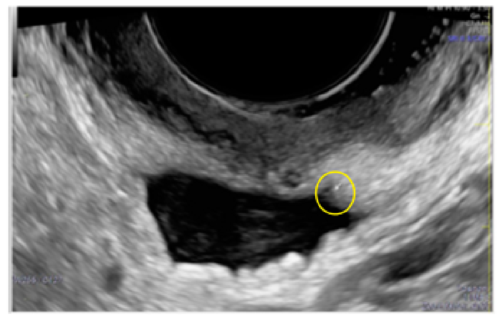 Diagnostics 13 01876 g005