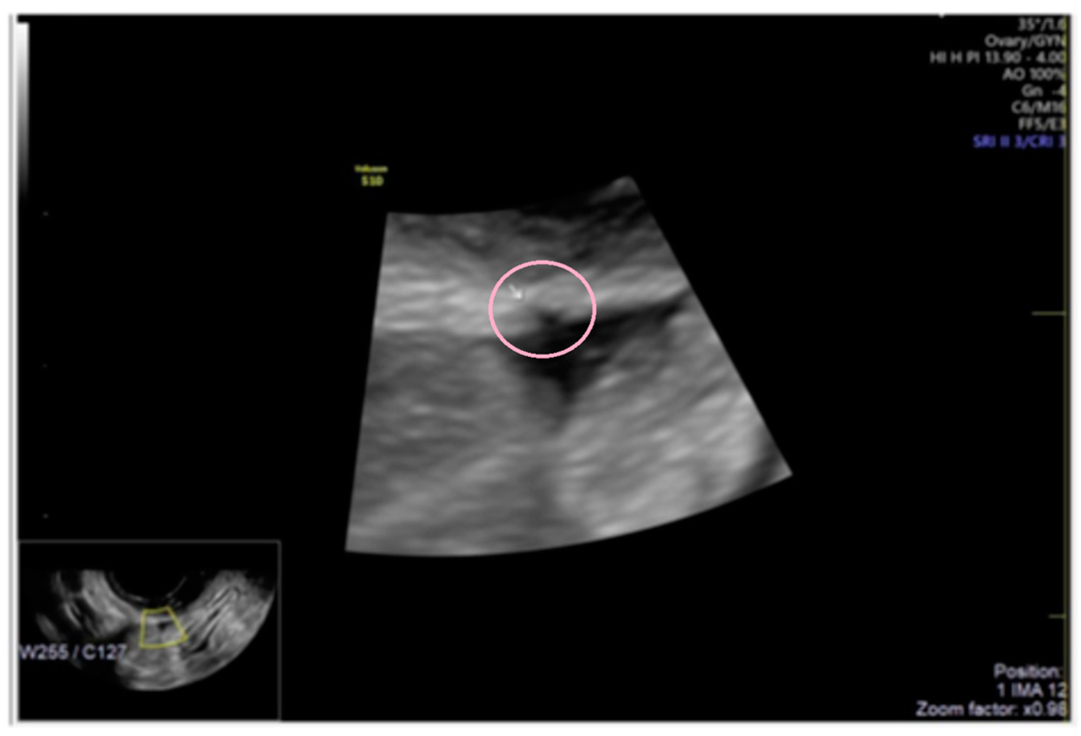 Diagnostics 13 01876 g006