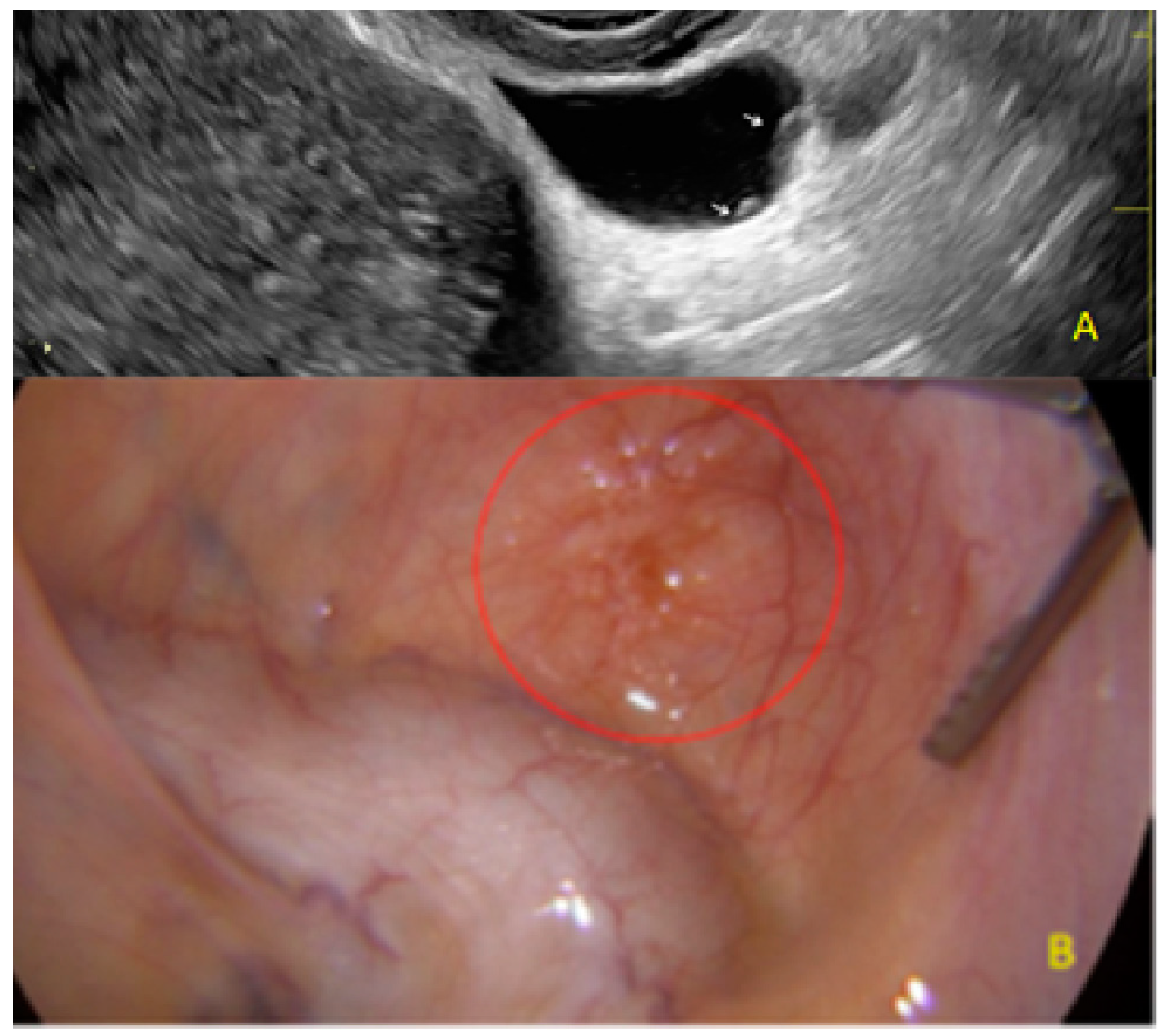 Diagnostics 13 01876 g008