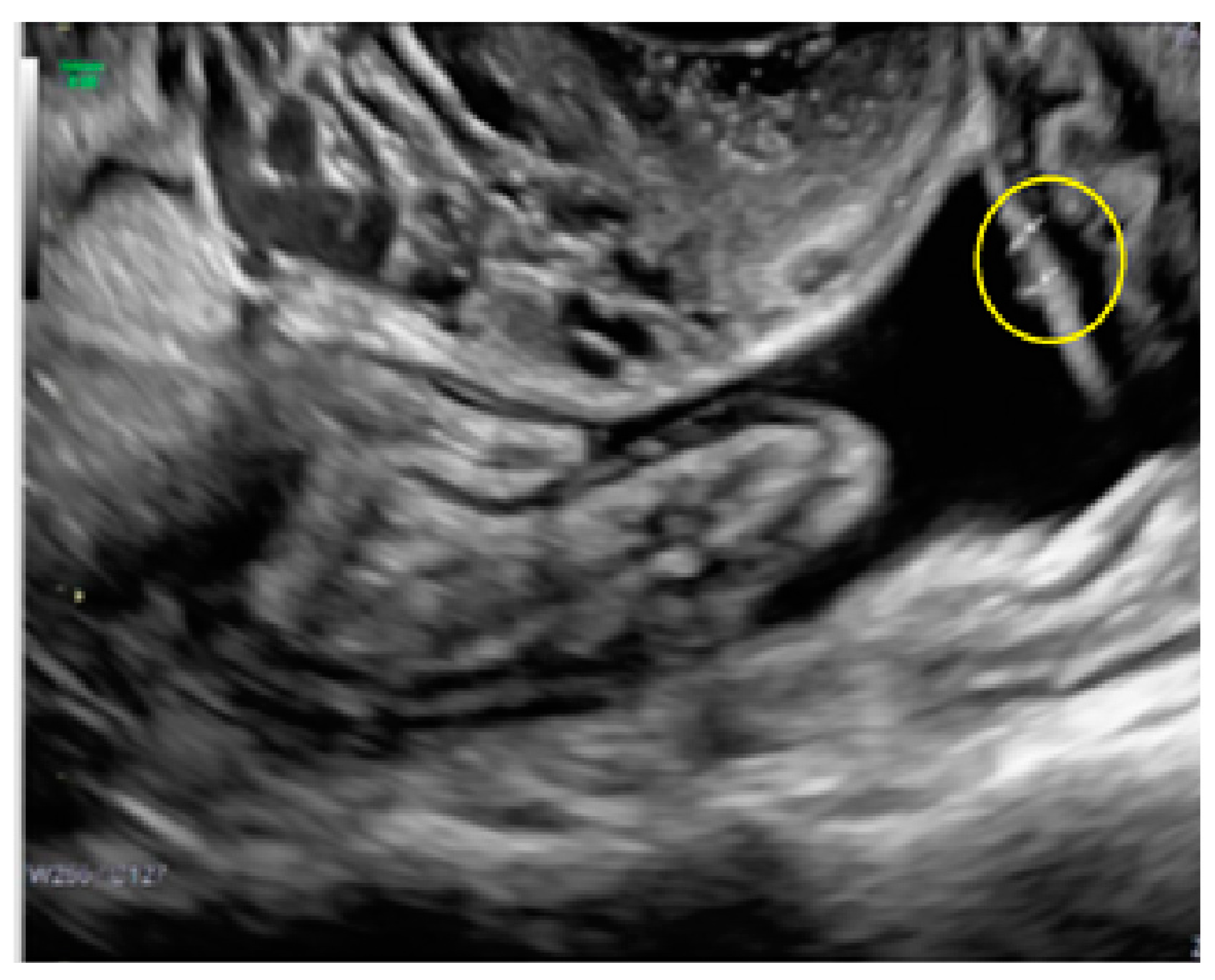 Diagnostics 13 01876 g009
