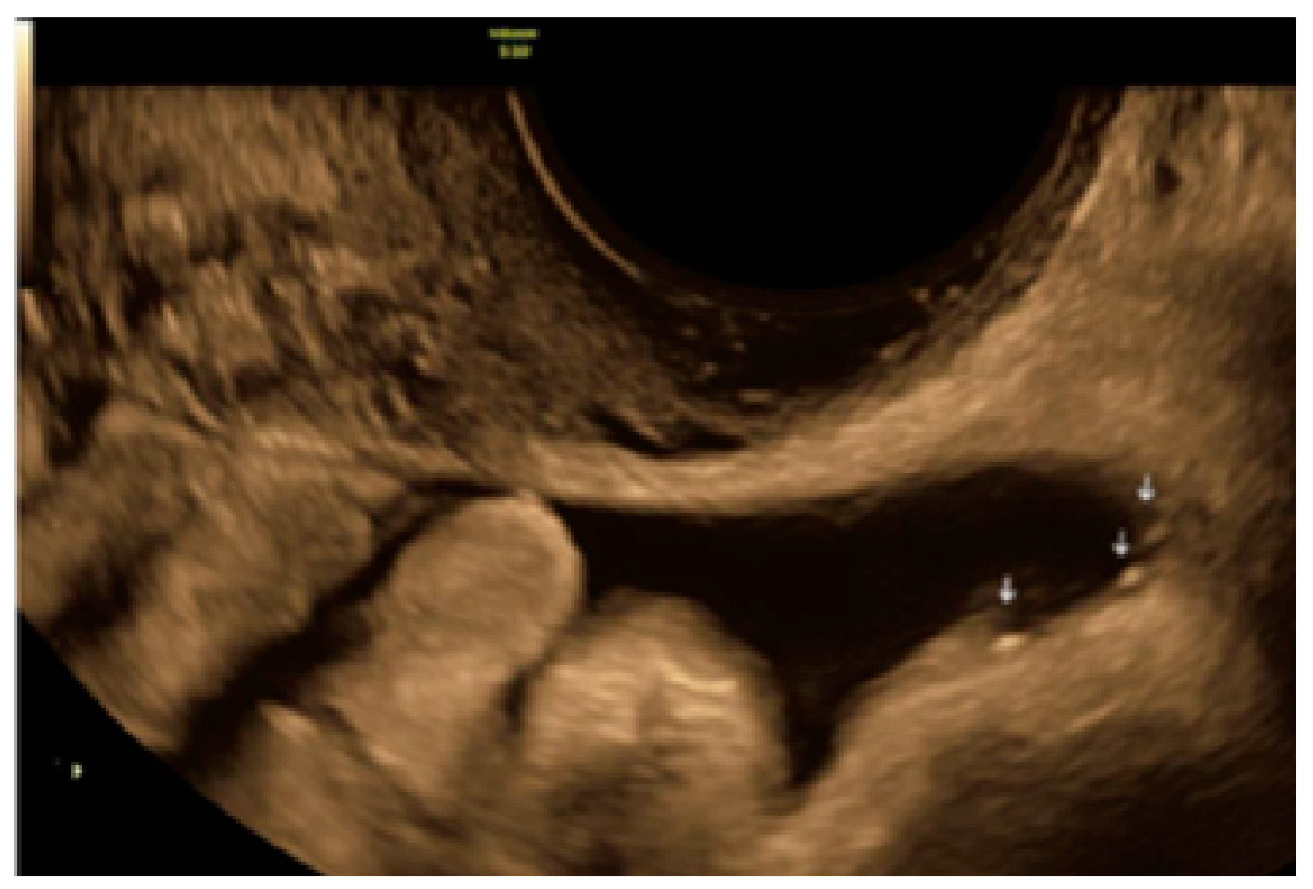 Diagnostics 13 01876 g010