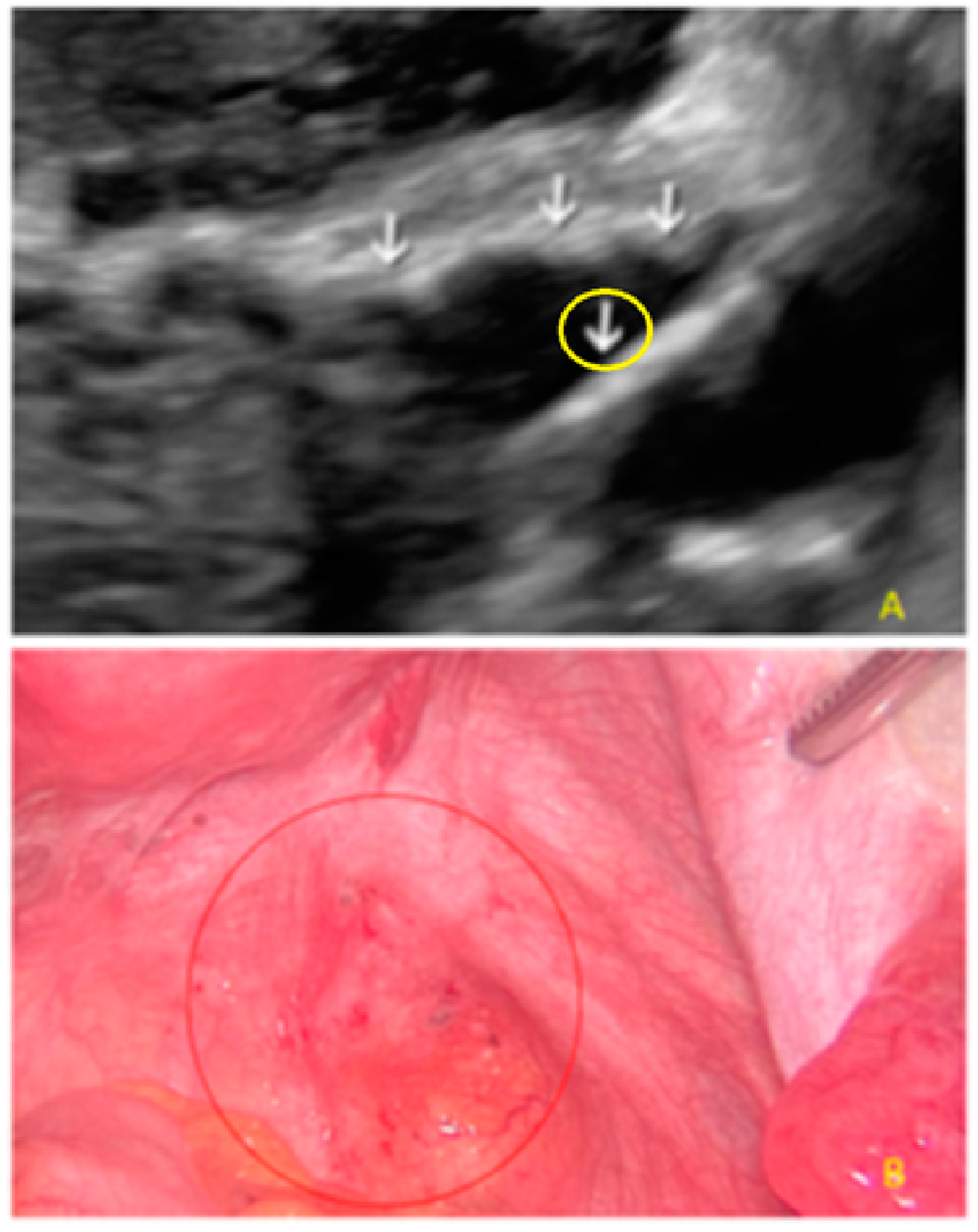 Diagnostics 13 01876 g011
