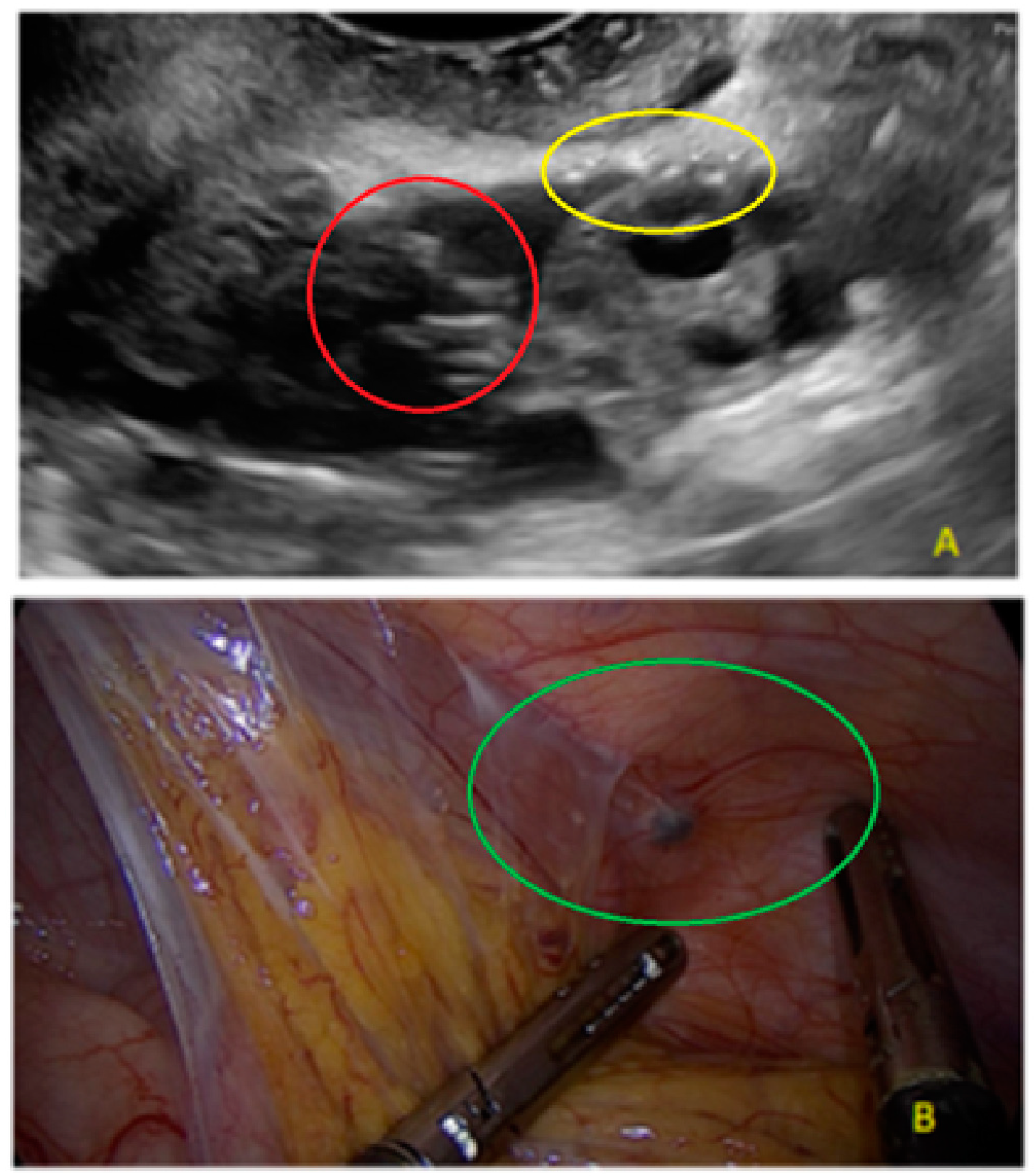 Diagnostics 13 01876 g012
