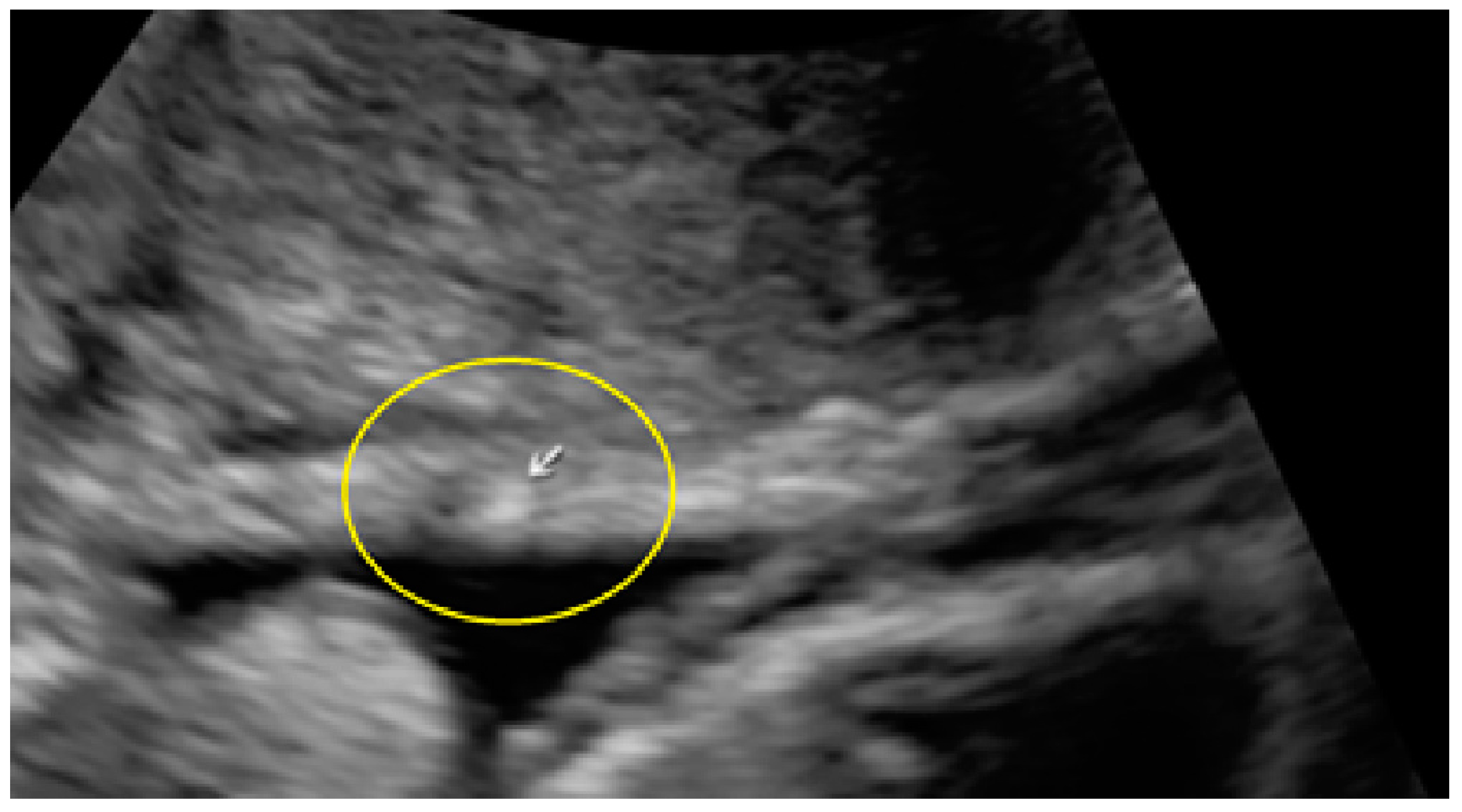 Diagnostics 13 01876 g013