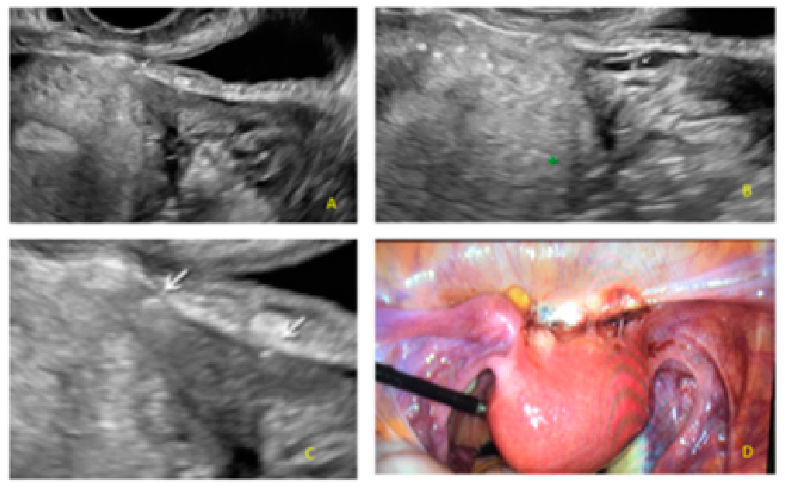 Diagnostics 13 01876 g014
