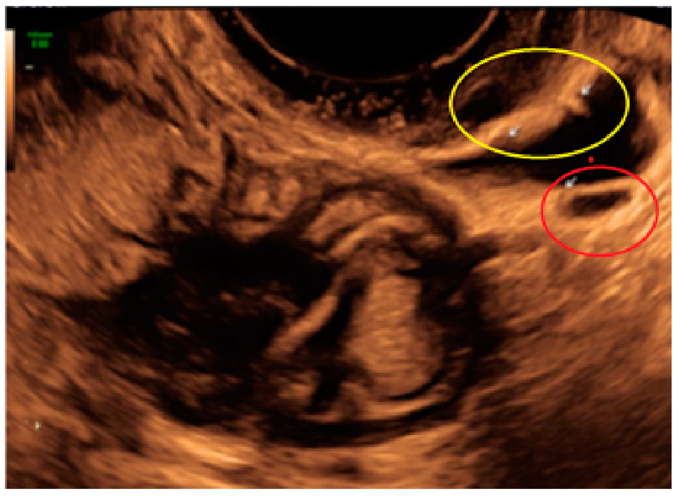 Diagnostics 13 01876 g015