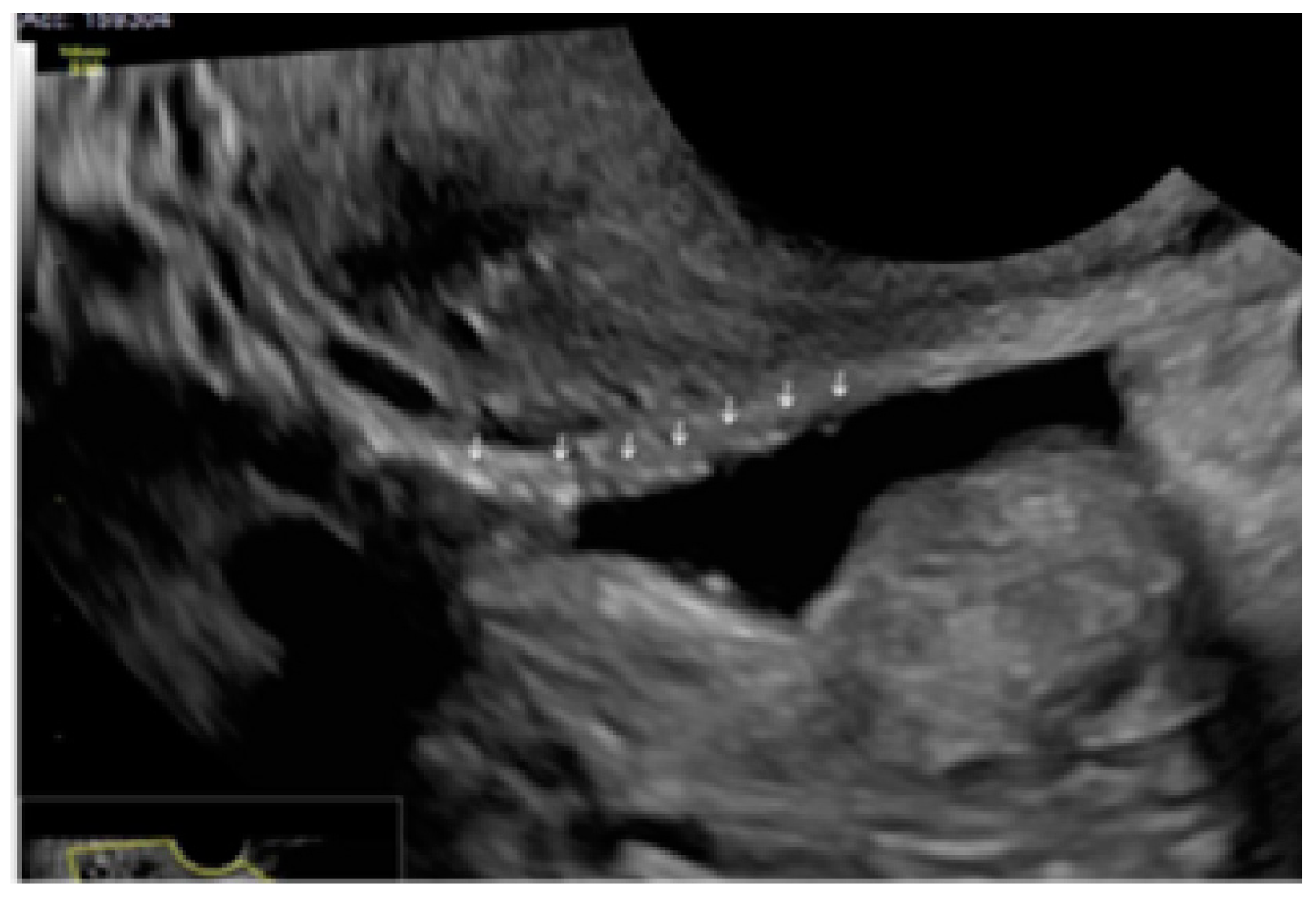 Diagnostics 13 01876 g016