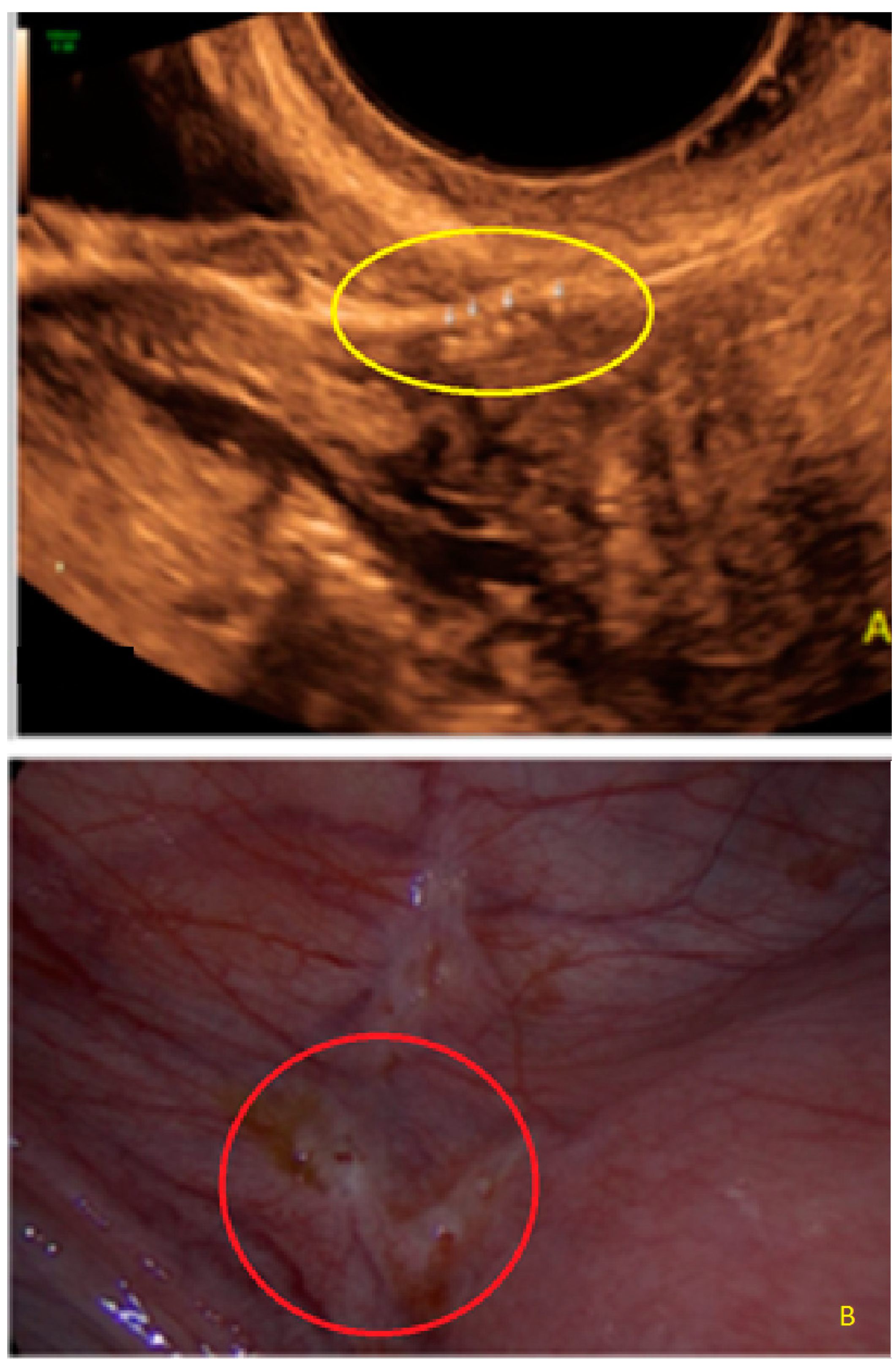 Diagnostics 13 01876 g017