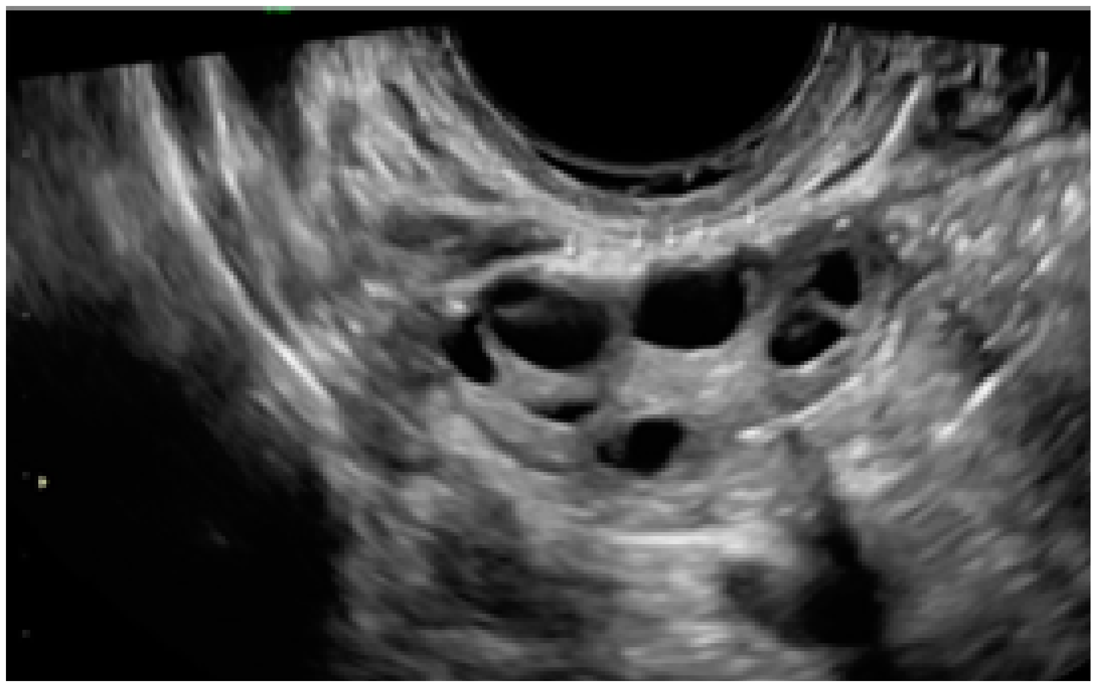 Diagnostics 13 01876 g019