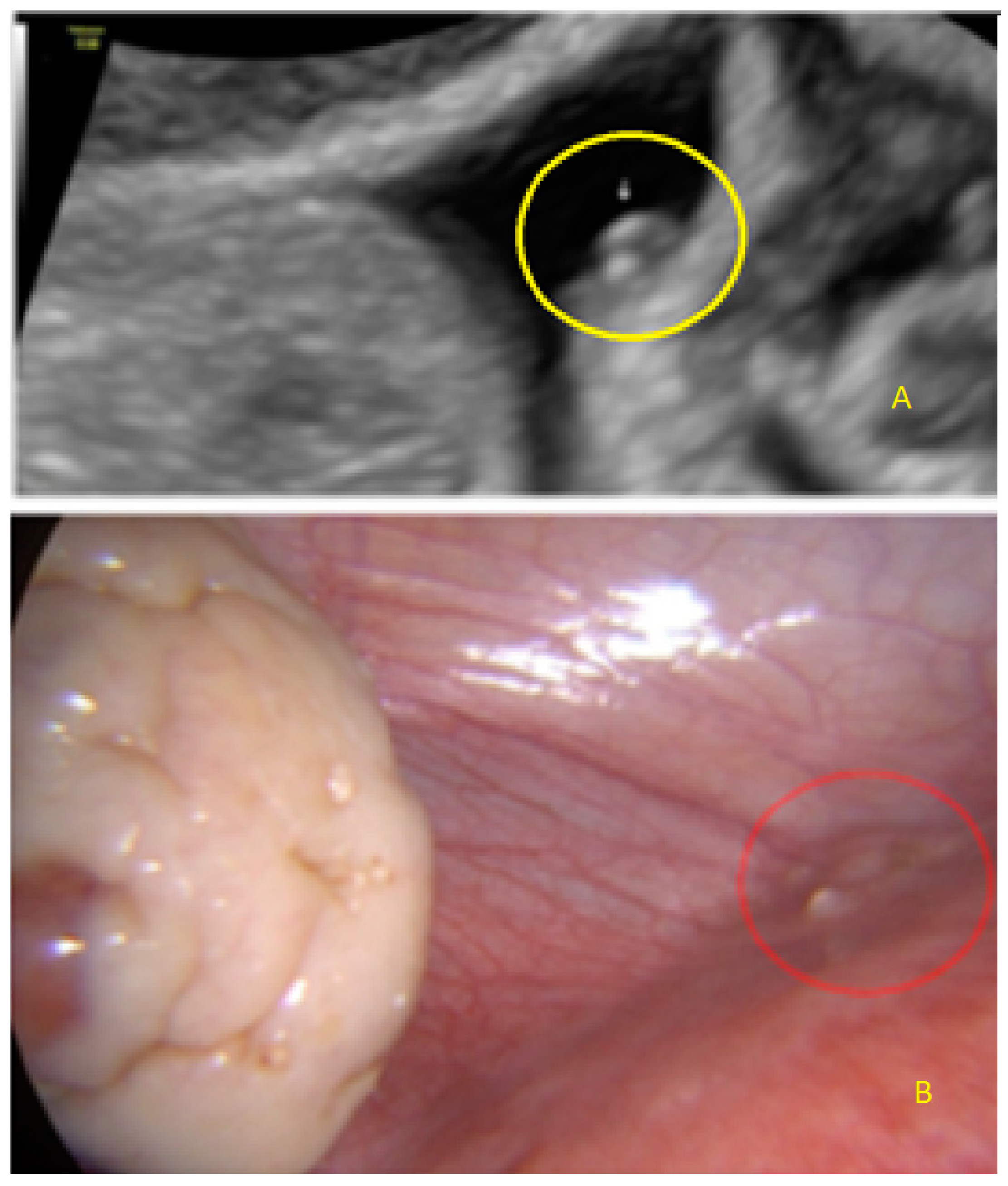 Diagnostics 13 01876 g021