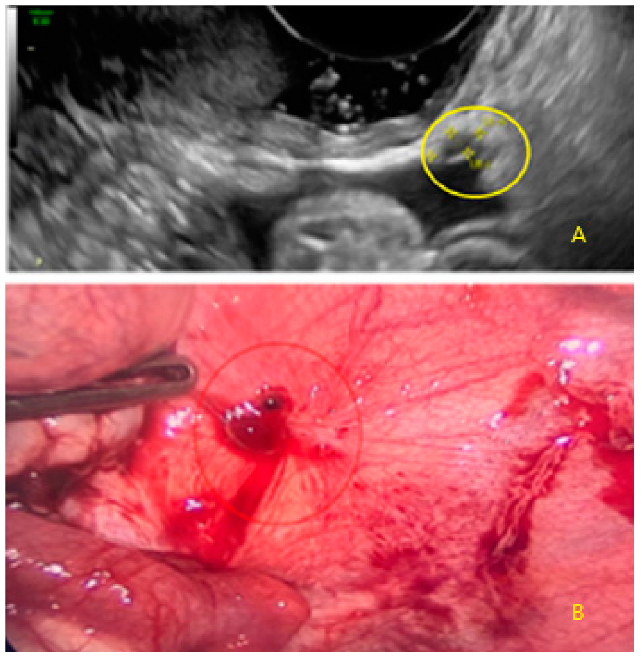 Diagnostics 13 01876 g022