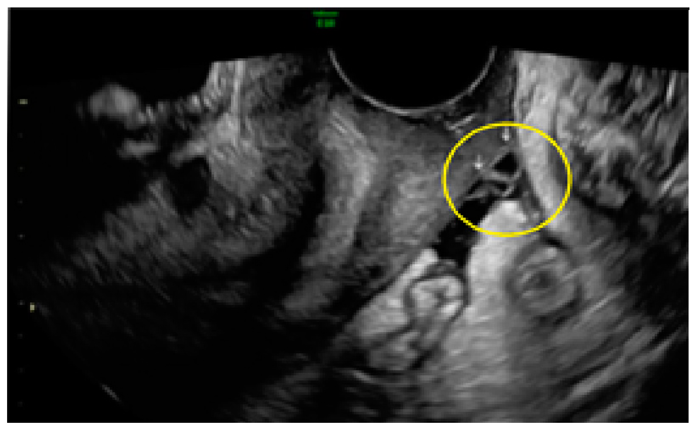 Diagnostics 13 01876 g023