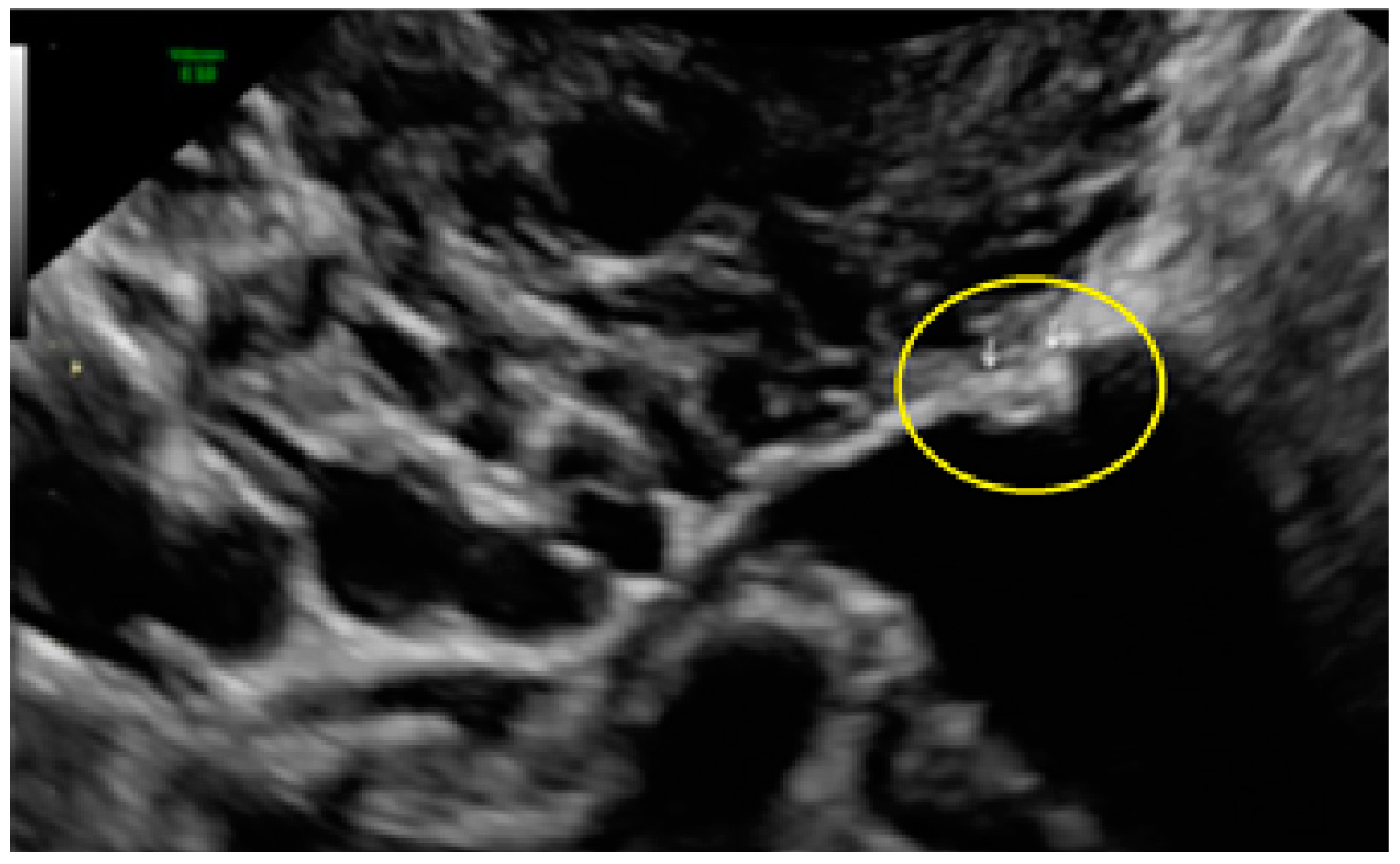Diagnostics 13 01876 g024